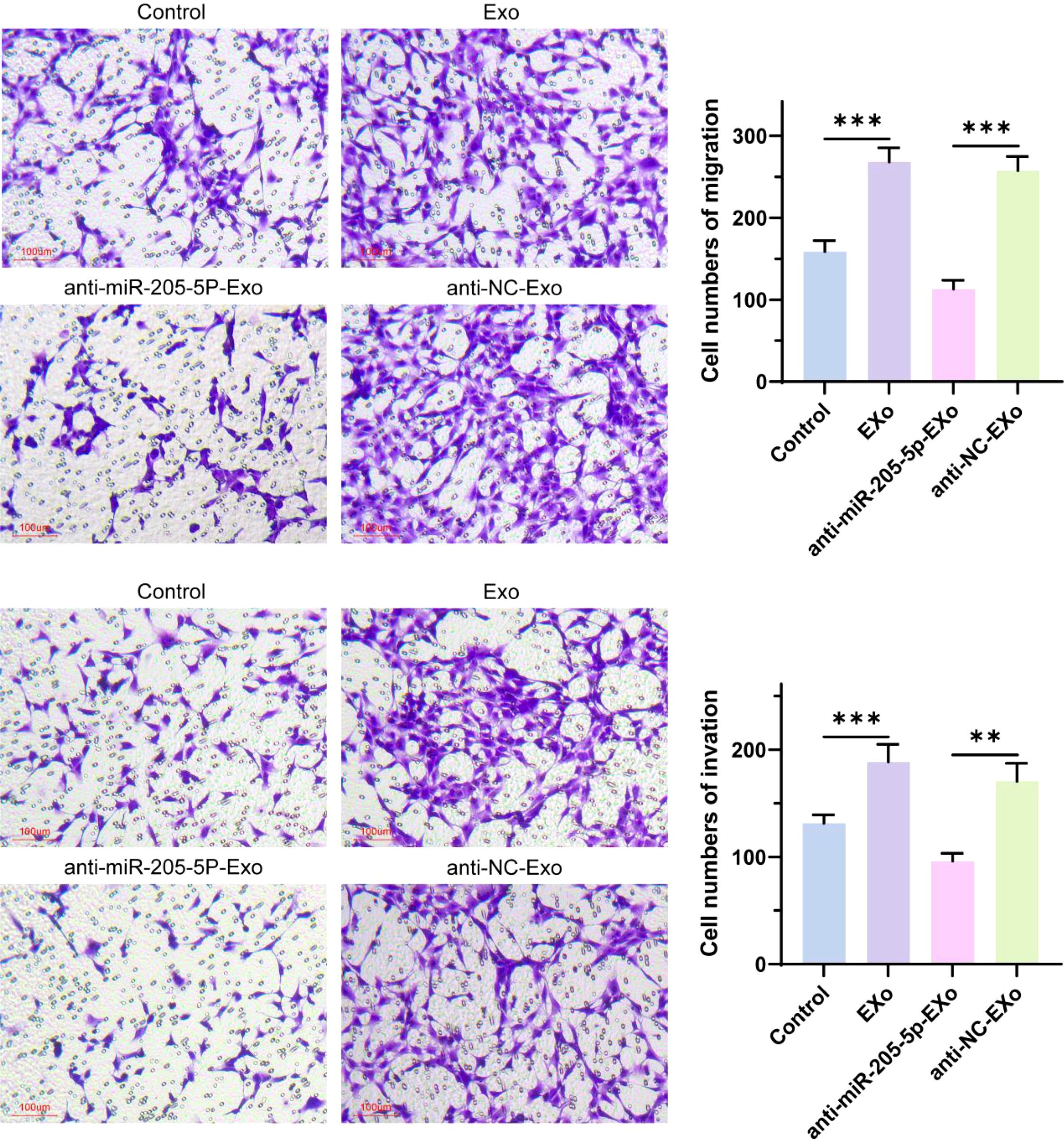 Microscopic images depicting cell migration and invasion assays under four conditions: Control, Exo, anti-miR-205-5P-Exo, and anti-NC-Exo. Stained cells are shown in purple. Adjacent bar graphs compare cell numbers, with Exo showing increased migration and invasion compared to the control and other treatments. Statistical significance is indicated by asterisks. Scale bars are present in images.
