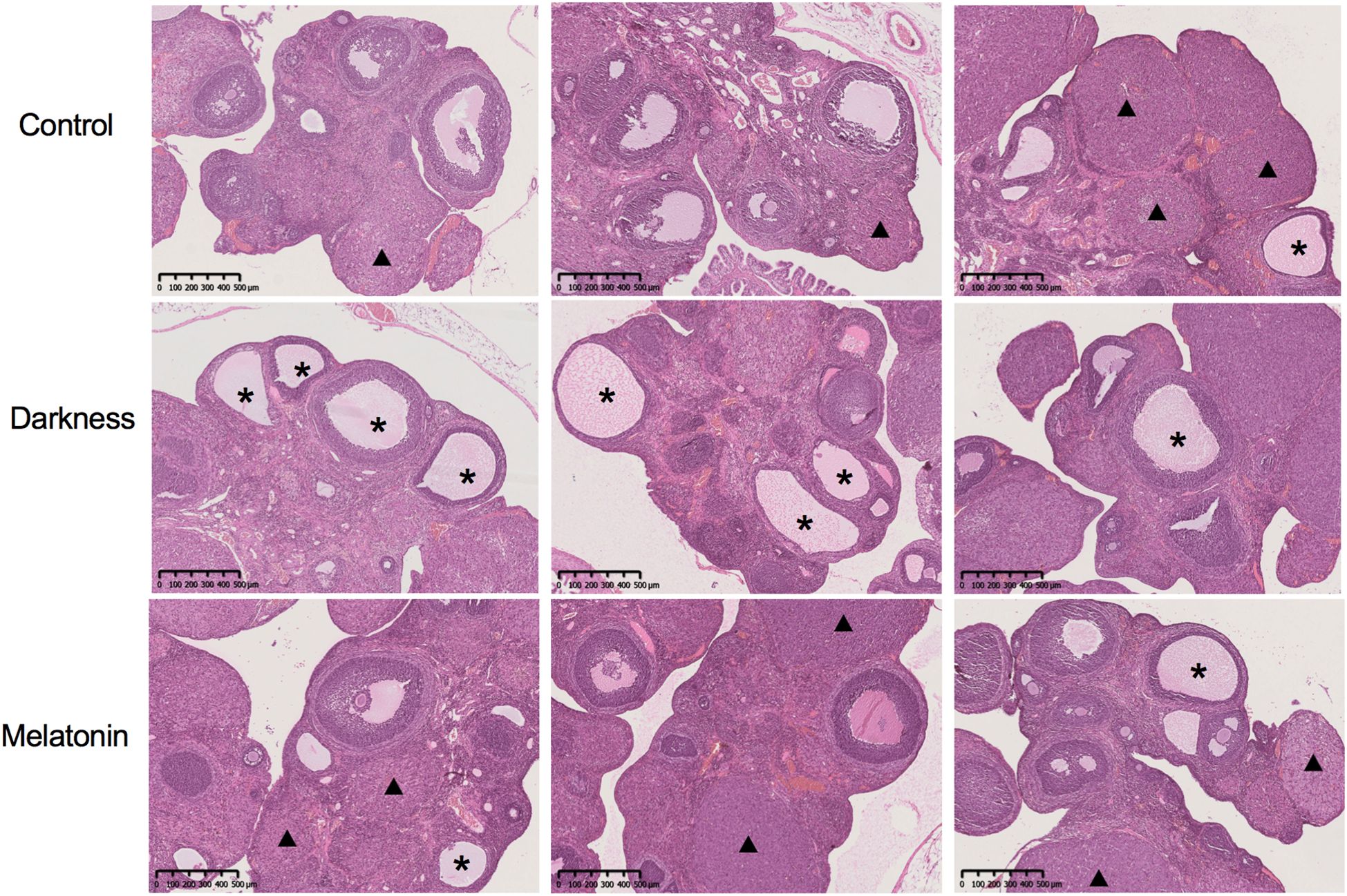 Histological images show glandular tissue under three conditions: Control with dense, clustered structures; Darkness with enlarged lumens marked by asterisks; Melatonin with moderate glandular density, some structures marked by triangles. Scale bars measure up to five hundred micrometers.