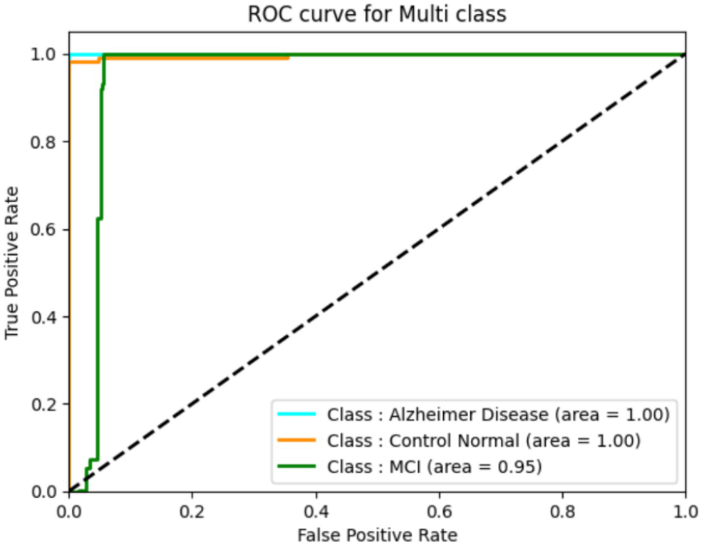 Receiver Operating Characteristic (ROC) curve for multi-class analysis showing three classes: Alzheimer's Disease and Control Normal with areas under the curve (AUC) of 1.00, and Mild Cognitive Impairment (MCI) with an AUC of 0.95. The plot has a diagonal reference line representing random performance.