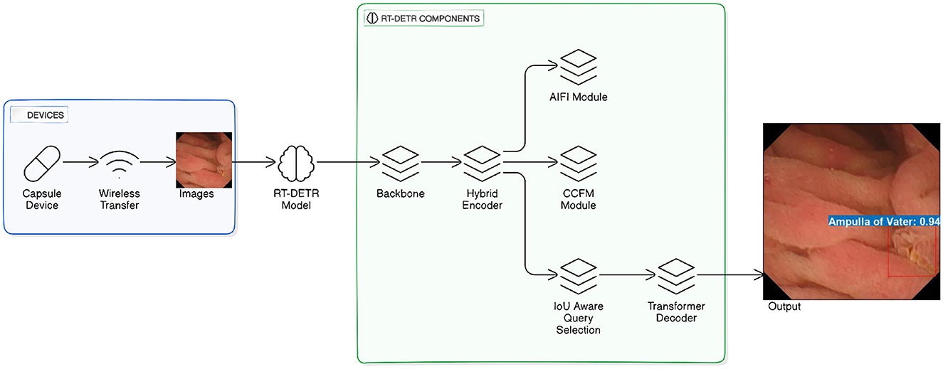 A system architecture diagram showing a pipeline for medical image analysis using a capsule endoscopy device and an RT-DETR model. The process begins with a capsule device capturing gastrointestinal images and wirelessly transmitting them. These images are fed into an RT-DETR model composed of components: Backbone, Hybrid Encoder, AIFI Module, CCFM Module, IoU Aware Query Selection, and Transformer Decoder. The output is a medical image with a label indicating the detected region, Ampulla of Vater: 0.94, highlighted in a red bounding box.