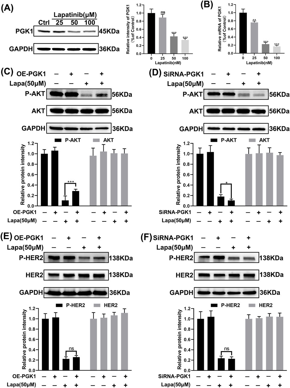 Western blot images and graphs illustrate the effect of Lapatinib on protein expression. Panels A-F show variations of PGK1, AKT, and HER2 with modifications such as OE-PGK1 and SiRNA-PGK1 under different Lapatinib concentrations. Protein bands and corresponding bar graphs detail expression levels. Statistical significance is indicated by asterisks.