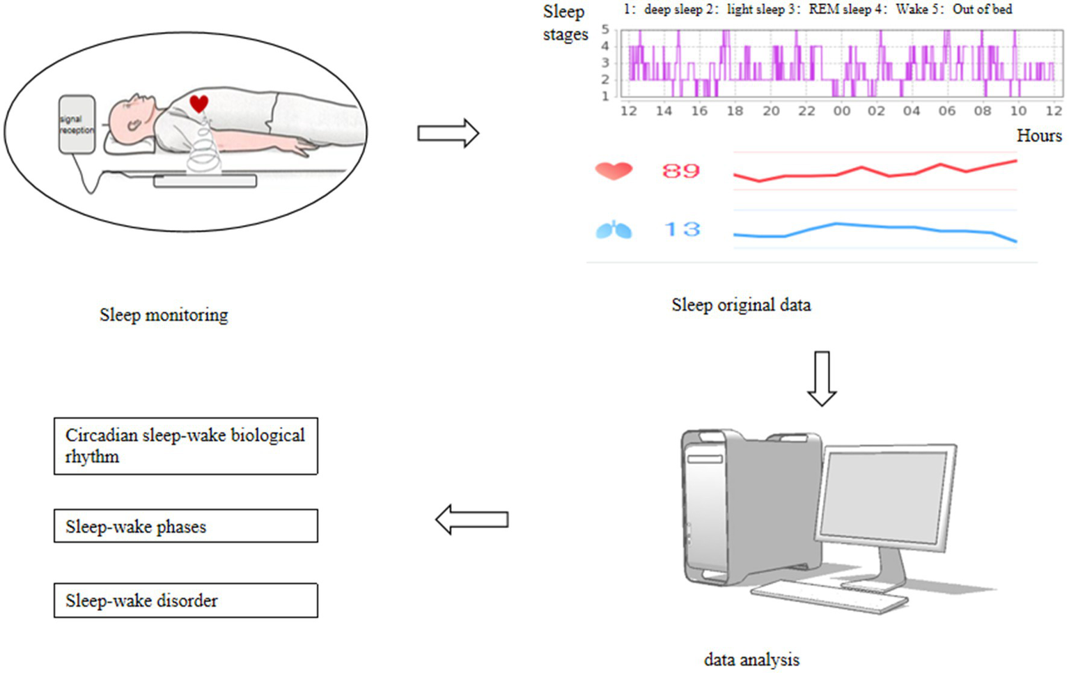 Diagram illustrating a sleep monitoring system. A person is shown lying on a bed with signal reception. A sleep stage chart displays data including deep sleep, light sleep, REM sleep, wake, and out of bed stages over hours. Heart and breathing rate graphs are included. Underneath, data analysis via a computer is highlighted, leading to outputs on circadian rhythm, sleep-wake phases, and disorders.