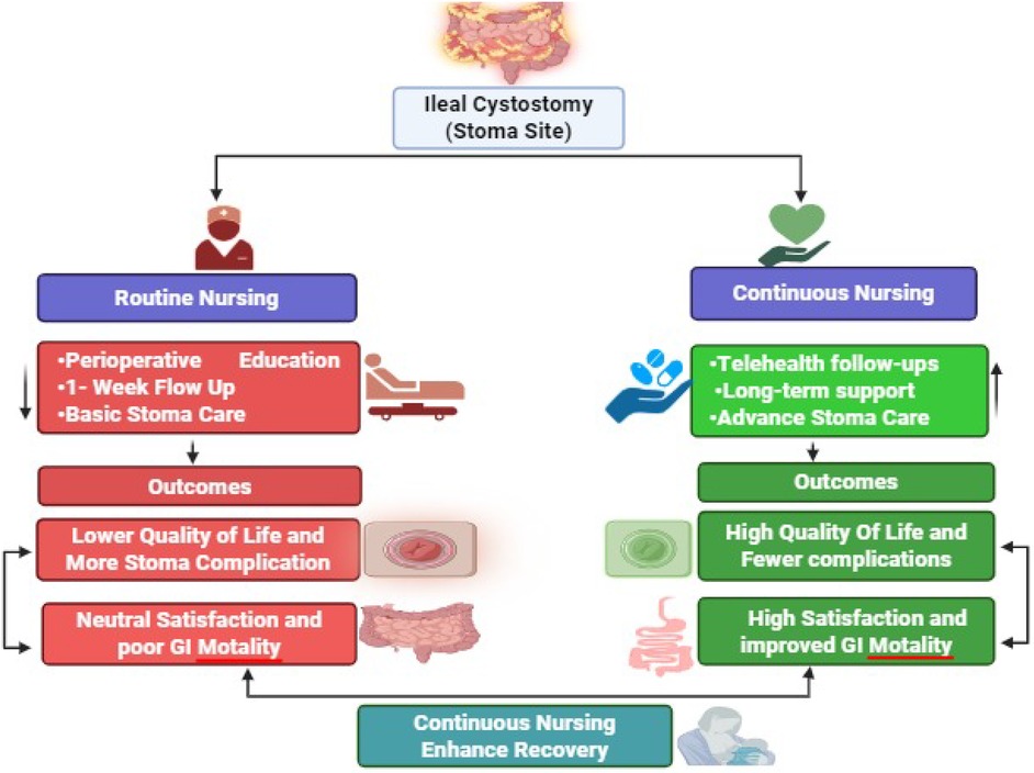 Infographic comparing routine nursing and continuous nursing for ileal cystostomy patients. Routine nursing includes perioperative education, one-week follow-up, and basic stoma care, resulting in lower quality of life, more stoma complications, neutral satisfaction, and poor gastrointestinal motility. Continuous nursing involves telehealth follow-ups, long-term support, and advanced stoma care, leading to higher quality of life, fewer complications, high satisfaction, and improved gastrointestinal motility, highlighting that continuous nursing enhances recovery.