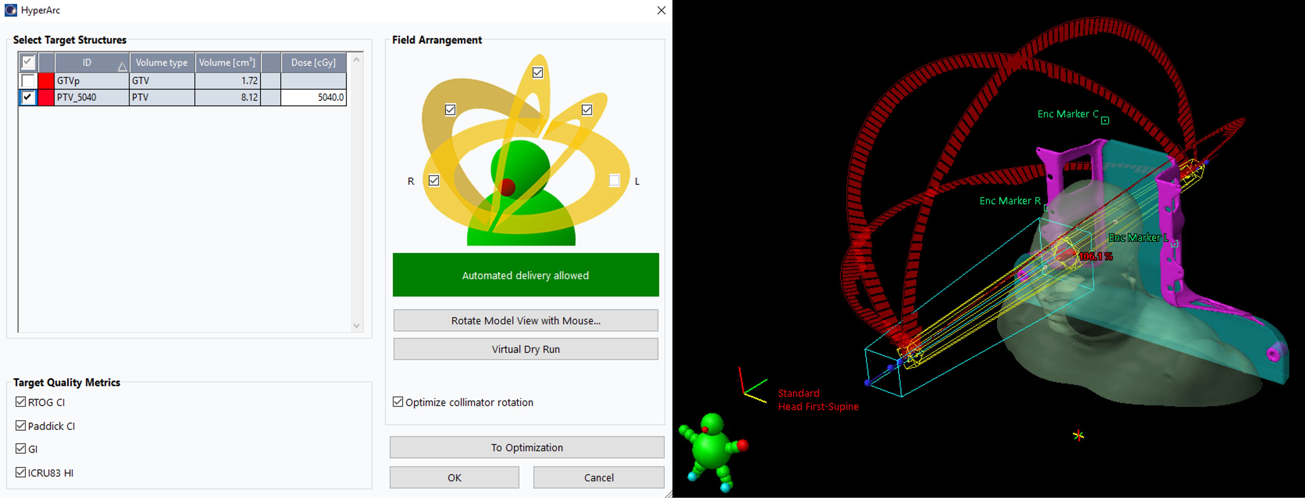 Medical software interface showing target structures for radiotherapy planning. The left side lists target volumes and doses, with GTV and PTV identifiers. The right side features a 3D simulation of beam arrangements around a head-shaped model. Visual markers and detailed trajectory paths indicate precise targeting within the setup.