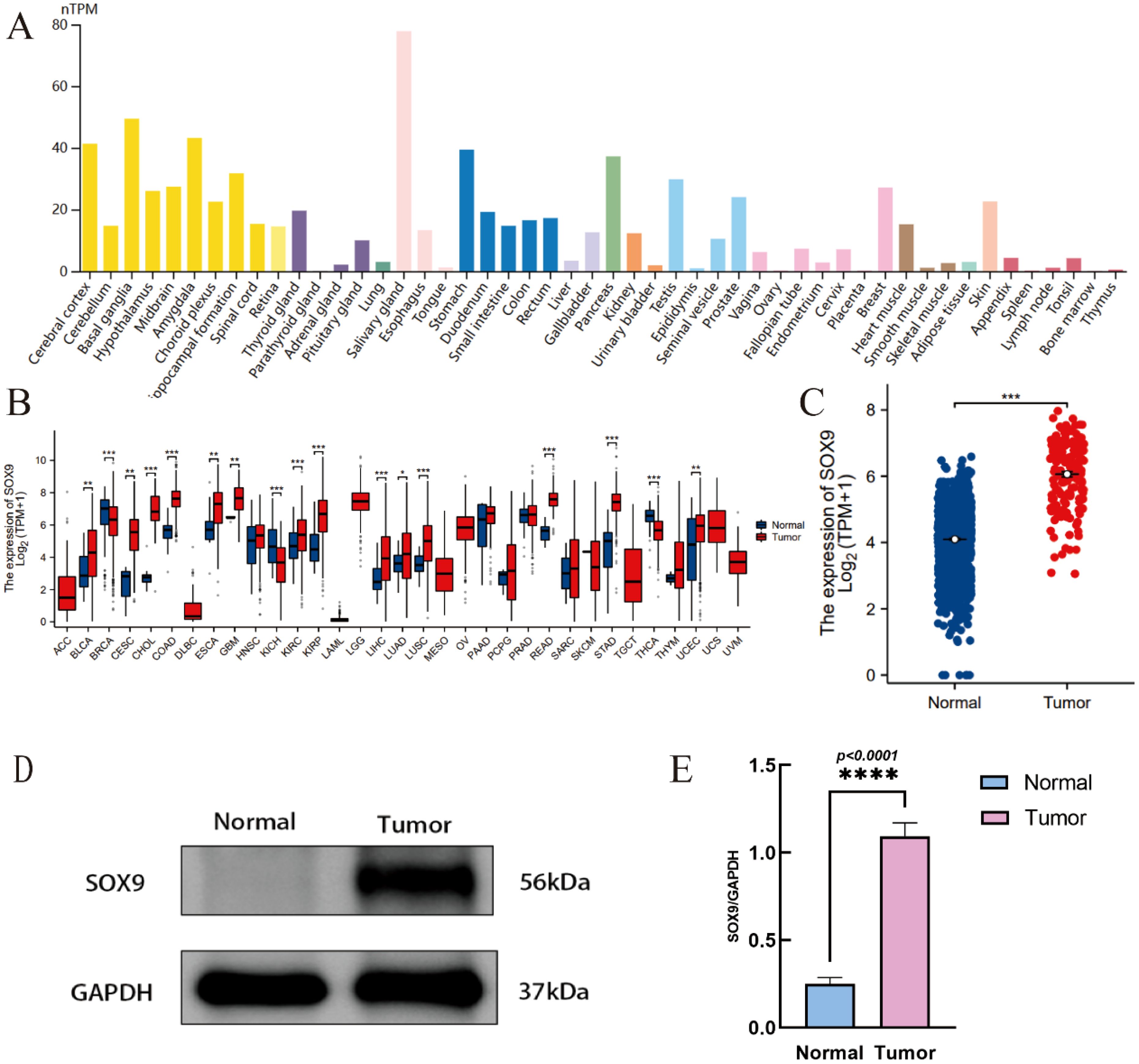 Panel A shows a bar graph depicting SOX9 expression across various tissues, with varying levels indicated by different colors. Panel B presents a box plot comparing SOX9 expression in normal versus tumor tissues across multiple cancer types, showing higher expression in tumors. Panel C is a scatter plot indicating significantly higher SOX9 expression in tumor samples compared to normal. Panel D displays a Western blot image comparing SOX9 and GAPDH protein levels between normal and tumor samples. Panel E shows a bar graph quantifying SOX9/GAPDH protein expression, significantly elevated in tumor samples.