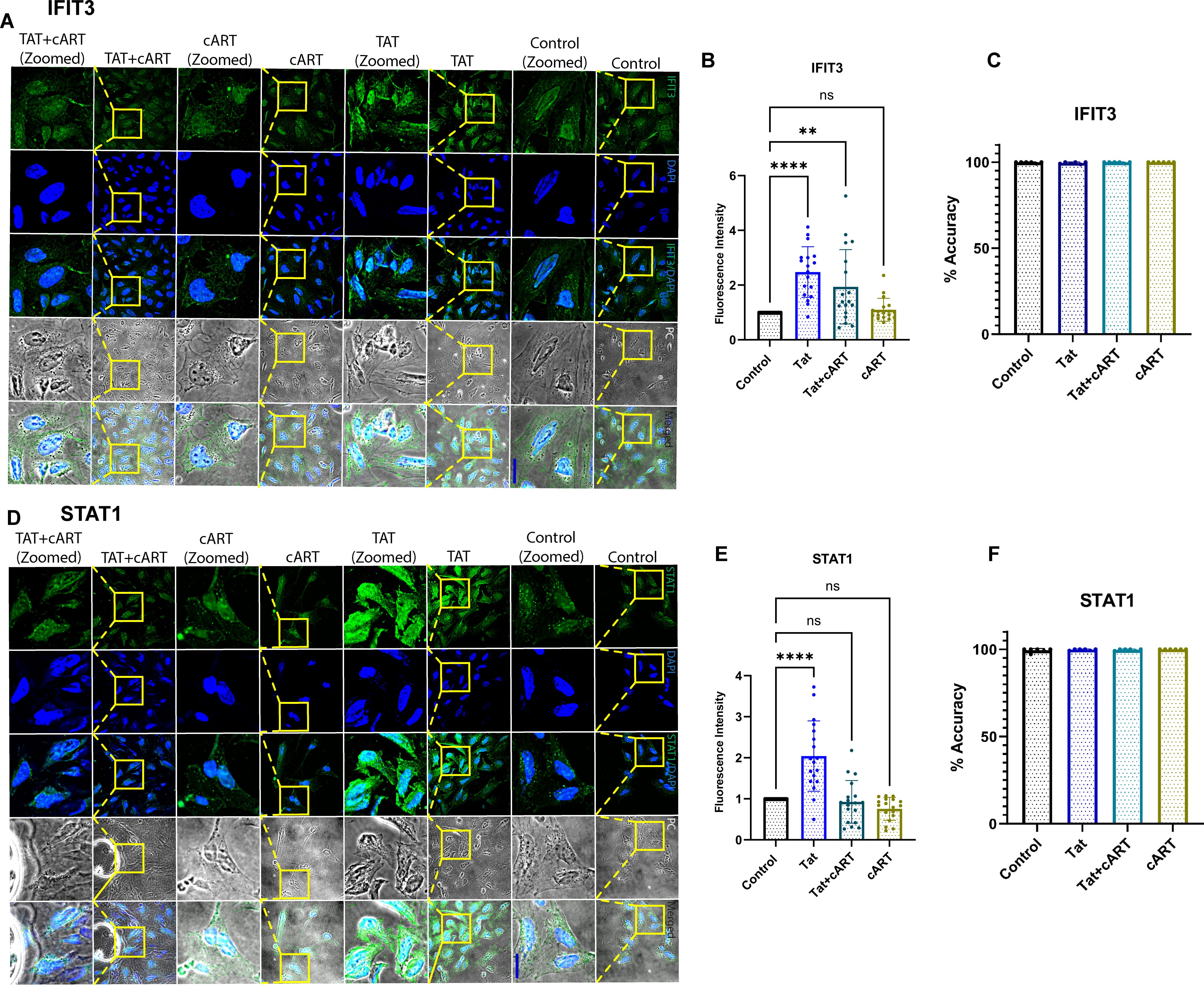 Fluorescence microscopy images and graphs show the expression of IFIT3 and STAT1 under different conditions: TAT+cART, cART, TAT, and Control. Panels A and D display cell images with fluorescence details and zoomed sections. Panels B and E present bar graphs of fluorescence intensity with statistical significance indicated by asterisks. Panels C and F show accuracy percentages for IFIT3 and STAT1, respectively, under each condition.