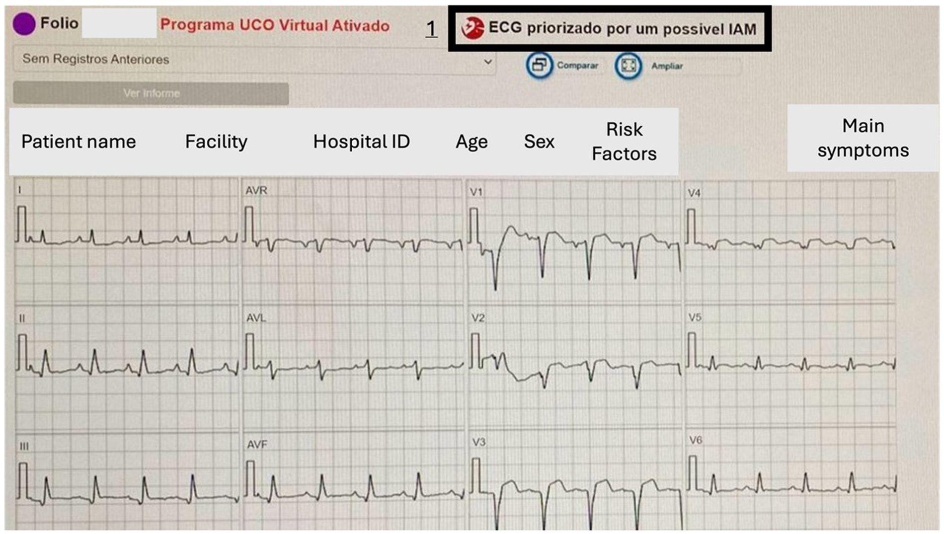 EKG report with multiple waveforms labeled from leads I, II, III, AVR, AVL, AVF, and V1 to V6. The report includes sections for patient name, facility, hospital ID, age, sex, risk factors, and main symptoms. A notification indicates the ECG is prioritized for possible myocardial infarction.