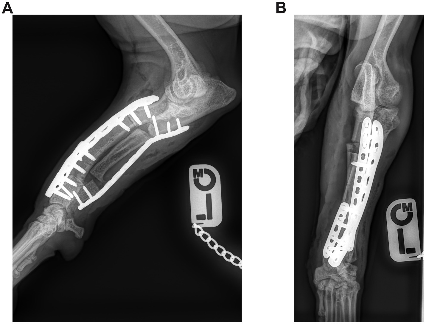 X-ray images labeled A and B depict bones with metal plates and screws for stabilization. Image A shows a side view with a large plate over the radius and ulna. Image B shows a frontal view with a different plate configuration. Both images include orthopedic markers.