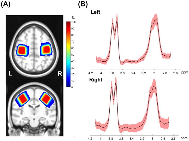 Panel A displays axial and coronal MRI slices with bilateral voxel placements in the sensorimotor cortex, overlaid with a color heatmap indicating voxel coverage probability from 0% (dark blue) to 100% (red). Panel B shows magnetic resonance spectroscopy (MRS) spectra for the left and right hemispheres, with black lines representing mean metabolite concentrations and red shading indicating standard error across participants. Peaks are shown between 2.6 and 4.2 parts per million (ppm).