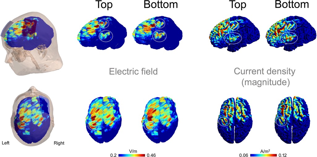 Simulation images showing electric field (left) and current density magnitude (right) distributions in the brain for two tDCS conditions labeled