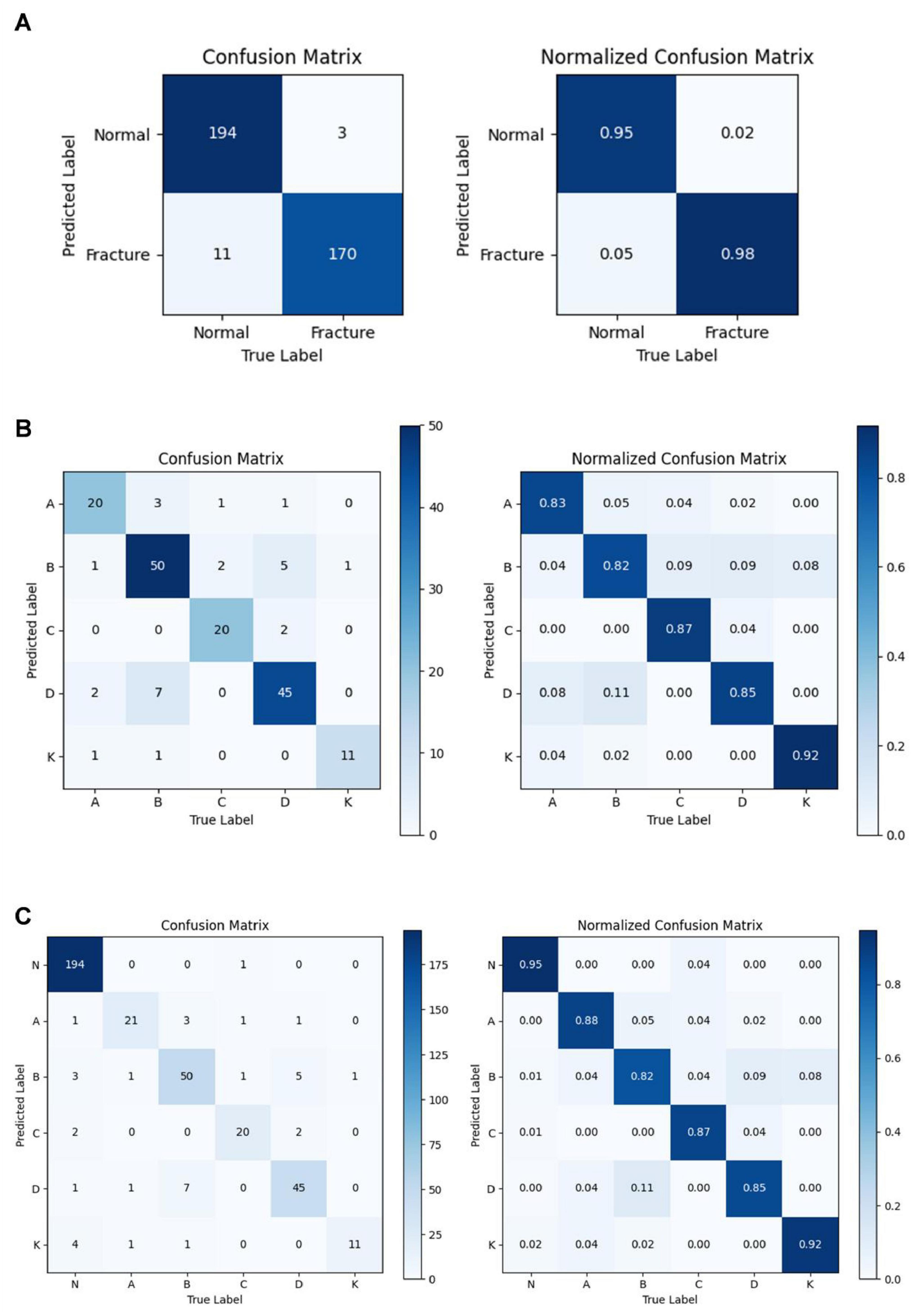 Three panels display confusion matrices and normalized confusion matrices for classification tasks. Panel A shows matrices distinguishing between normal and fracture labels with high accuracy. Panel B shows matrices with labels A through K, exhibiting variable prediction accuracy. Panel C combines these datasets, comparing predictions across normal and labels A, B, C, D, and K. Each panel includes a color scale to represent accuracy, with darker shades indicating higher values.
