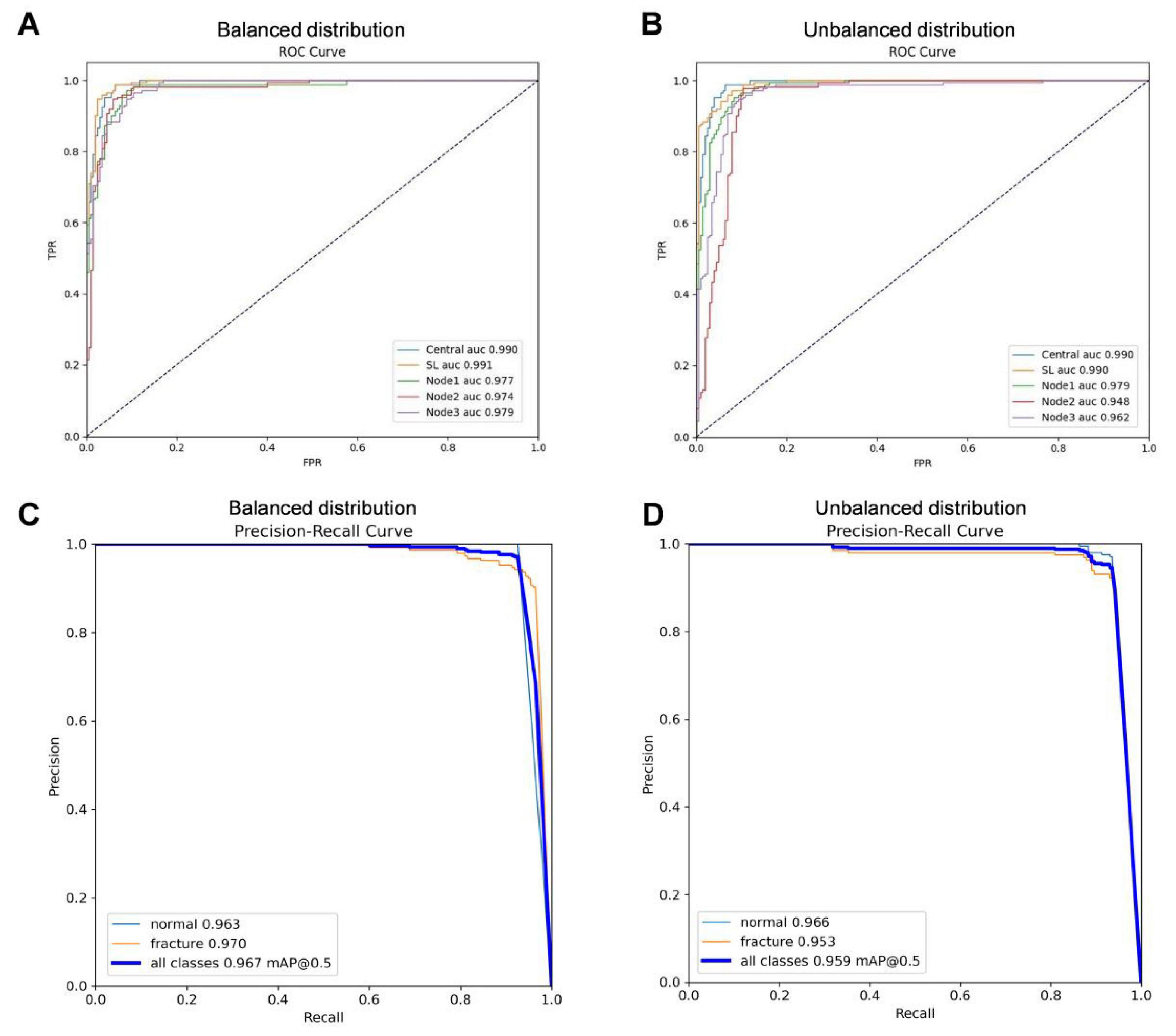 Panel A shows an ROC curve for a balanced distribution with AUC scores: Central 0.990, SL 0.991, Node1 0.977, Node2 0.974, Node3 0.979. Panel B displays an ROC curve for an unbalanced distribution with AUC scores: Central 0.990, SL 0.990, Node1 0.997, Node2 0.948, Node3 0.962. Panel C depicts a precision-recall curve for a balanced distribution with precision scores: normal 0.963, fracture 0.970, all classes 0.967. Panel D illustrates a precision-recall curve for an unbalanced distribution with scores: normal 0.966, fracture 0.953, all classes 0.959.