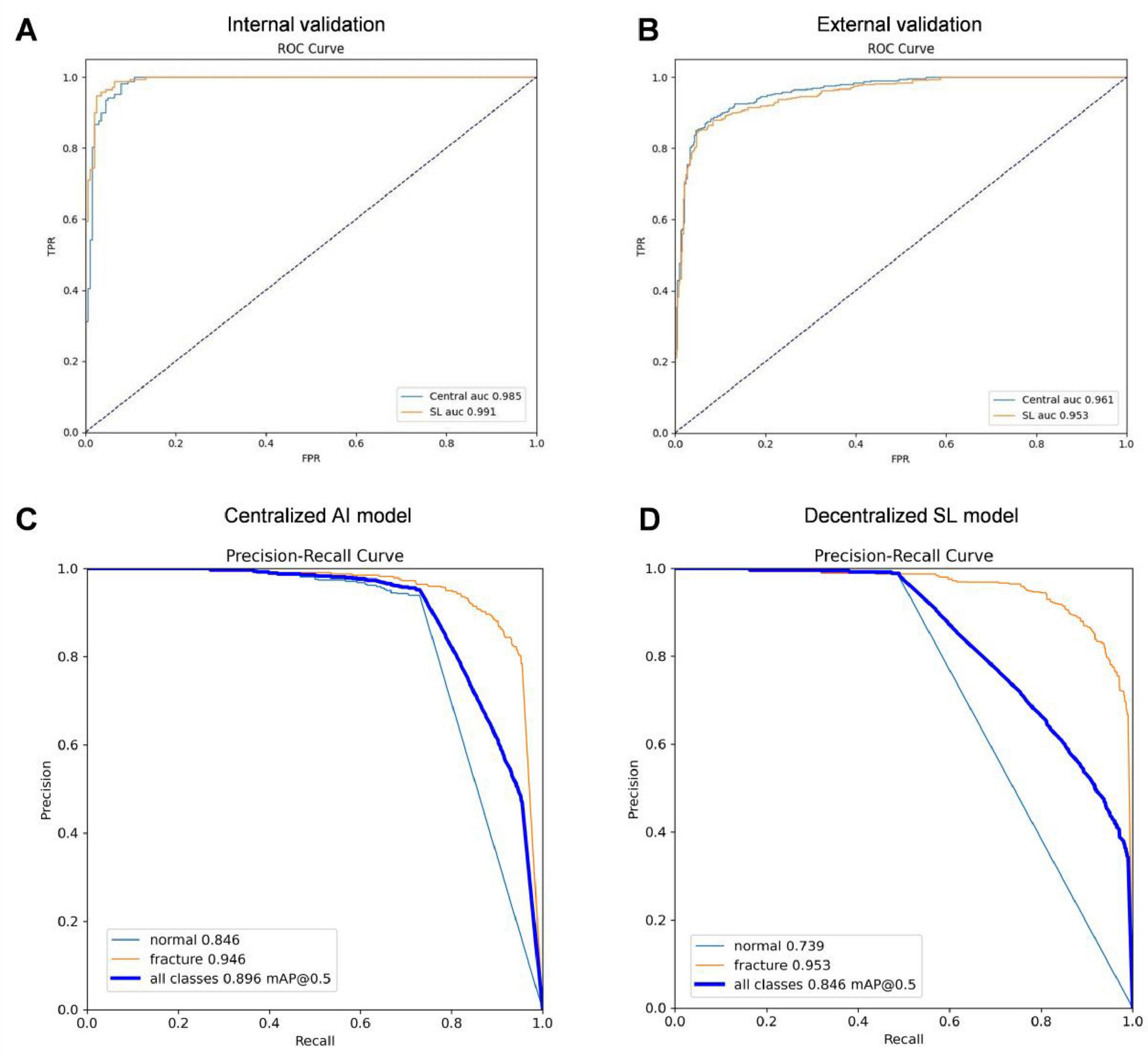 Graphs A and B show ROC curves for internal and external validation, with central and SL models having AUC values of 0.985/0.991 and 0.961/0.953, respectively. Graphs C and D display Precision-Recall curves for centralized and decentralized SL models. Centralized model has performance metrics: normal 0.846, fracture 0.946, all classes 0.896 mAP@0.5. Decentralized model metrics: normal 0.739, fracture 0.953, all classes 0.846 mAP@0.5.