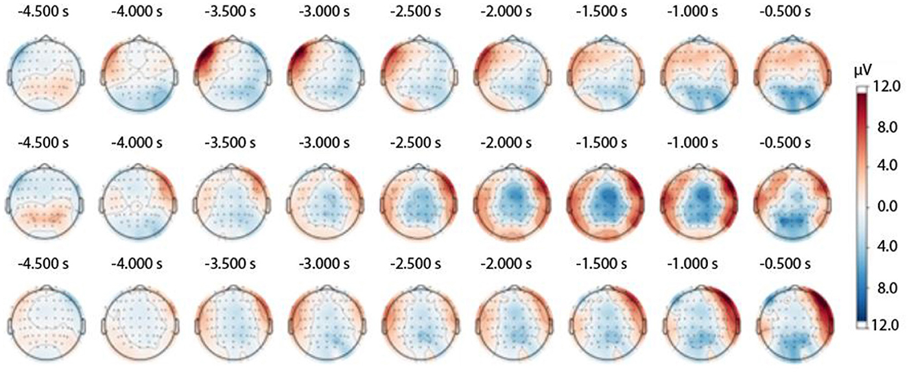 A sequence of topographical brain maps shows electrical activity over time from -4.5 to -0.5 seconds. Red and blue colors indicate different microvolt levels, as per the adjacent color scale ranging from -12.0 to 12.0 μV.