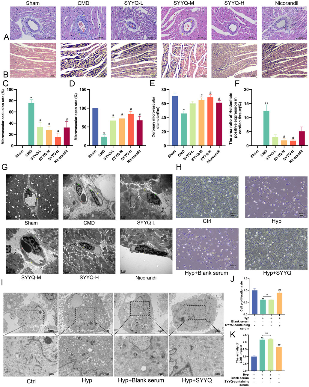 Histological and microscopic images compare different treatments: Sham, CMD, SYYQ-L, SYYQ-M, SYYQ-H, and Nicorandil. Panels A and B show stained tissue sections, while panels G and I present electron microscopy images. Graphs C, D, E, F, J, and K display quantitative data on microvascular metrics, cell proliferation, and activity levels, highlighting variations across treatments. Panel H shows cultured cells under different conditions. Each section demonstrates distinct structural and cellular differences, indicating the effects of various treatments.