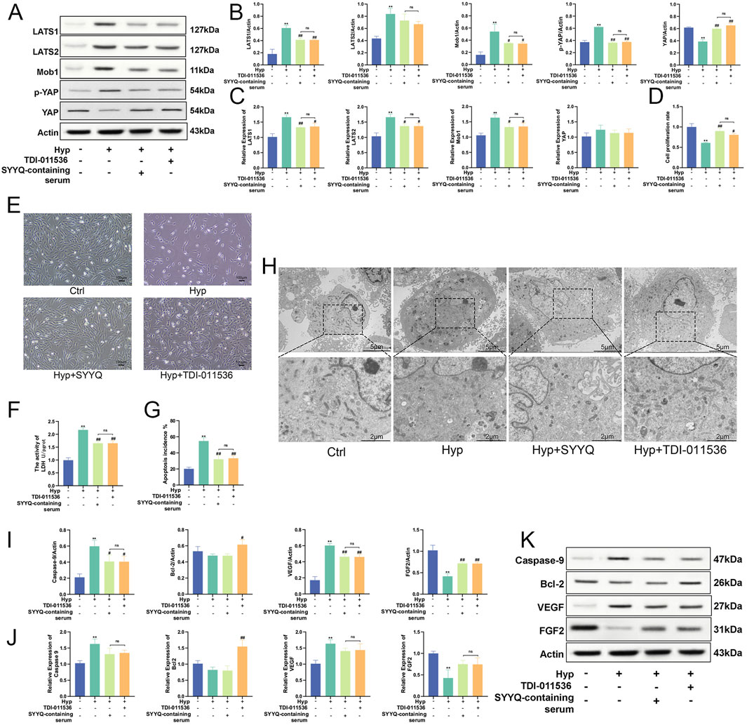 Western blot and bar graph images showing protein expression levels under different conditions. Panels A and K display results for proteins like LATS1, LATS2, p-YAP, YAP, caspase-9, Bcl-2, VEGF, and FGF2. Panels B, C, D, F, G, I, and J present quantitative data in bar graphs with various treatments: TDI-011536, SYYQ-containing serum, and control. Panel E shows cell morphology under different treatments. Panel H contains transmission electron microscopy images of cells, highlighting ultrastructural differences.