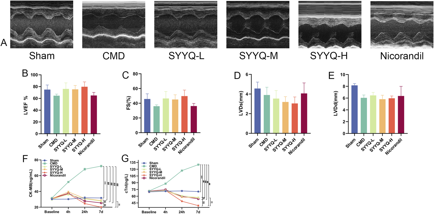 Panel of images and graphs depicting cardiac function assessments. Panel A shows ultrasound images for groups: Sham, CMD, and various SYYQ treatments. Panels B to E display bar graphs with different treatments on the x-axis. Panel B (LVEF%), Panel C (FS%), Panel D (LVDs), and Panel E (LVDd) depict cardiac metric comparisons among groups. Panels F and G are line graphs showing CK-MB and cTnI levels over time intervals: baseline, 4 hours, 24 hours, and 7 days, for each treatment group.