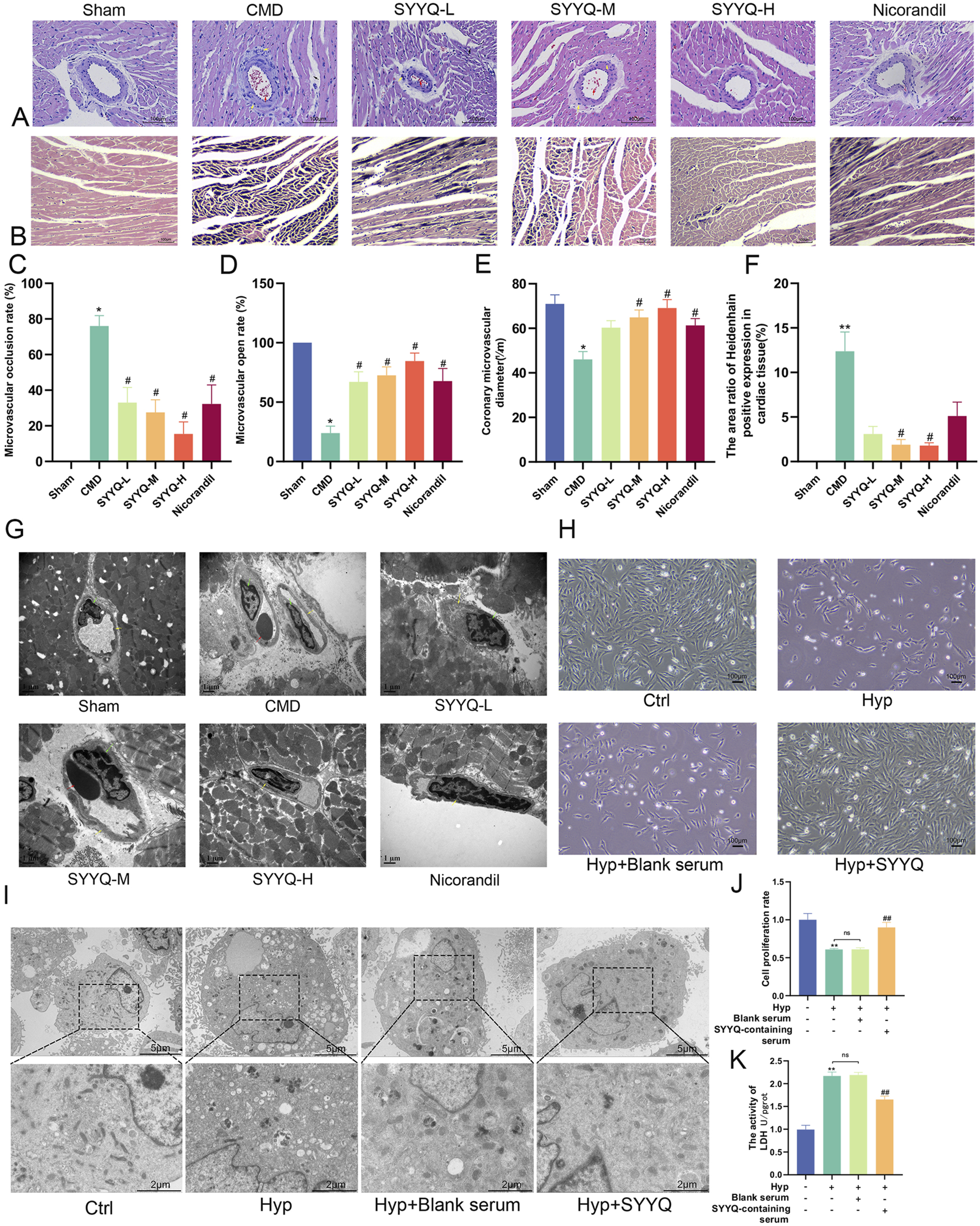 Histological and microscopic images compare different treatments: Sham, CMD, SYYQ-L, SYYQ-M, SYYQ-H, and Nicorandil. Panels A and B show stained tissue sections, while panels G and I present electron microscopy images. Graphs C, D, E, F, J, and K display quantitative data on microvascular metrics, cell proliferation, and activity levels, highlighting variations across treatments. Panel H shows cultured cells under different conditions. Each section demonstrates distinct structural and cellular differences, indicating the effects of various treatments.