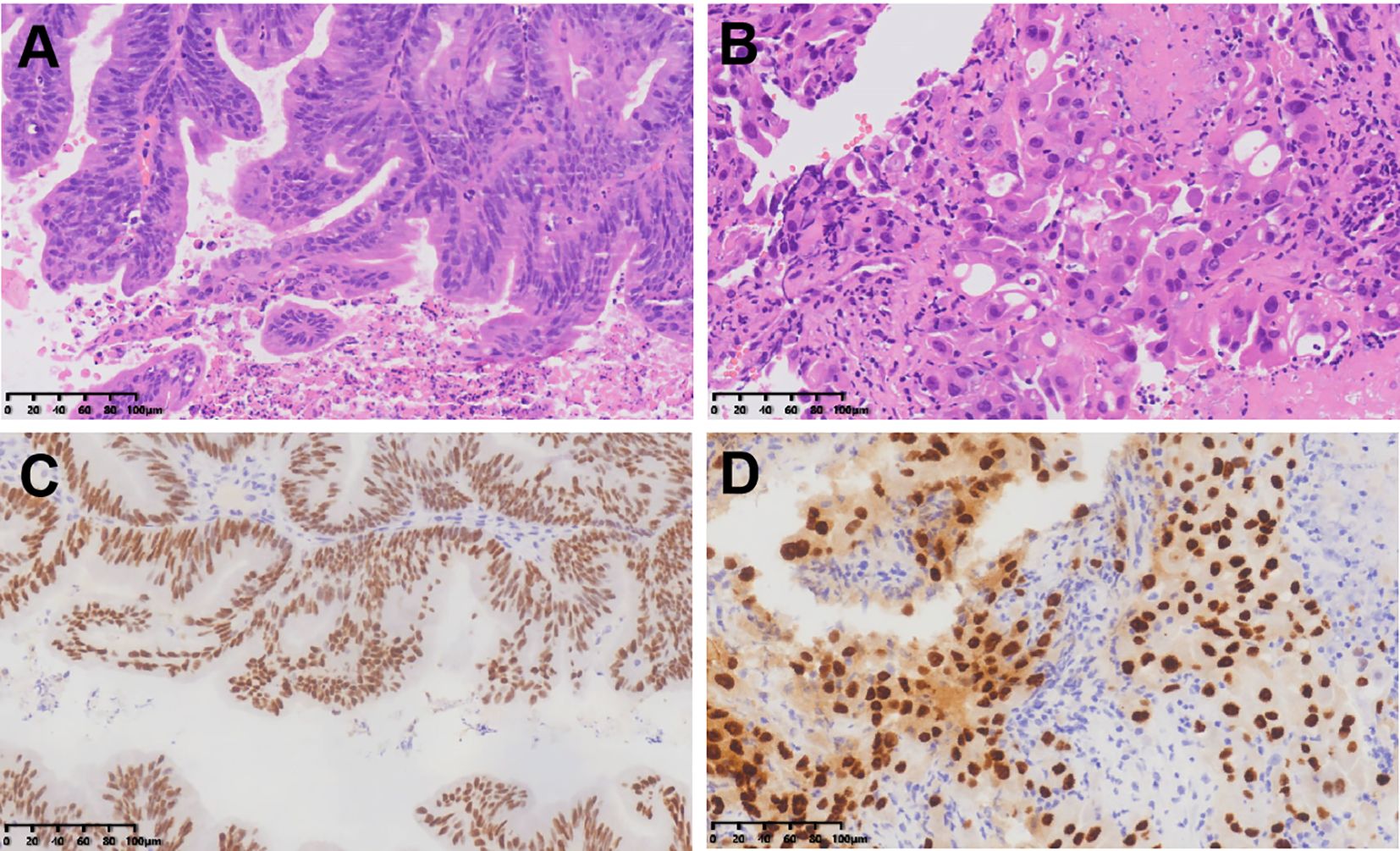 Four-panel histological images labeled A to D. Panels A and B show pink and purple stained tissue sections, indicating different tissue structures with varying cell densities. Panels C and D depict brown-stained sections likely indicating specific protein expressions within the tissue. Each panel includes a scale indicator at the bottom for reference.