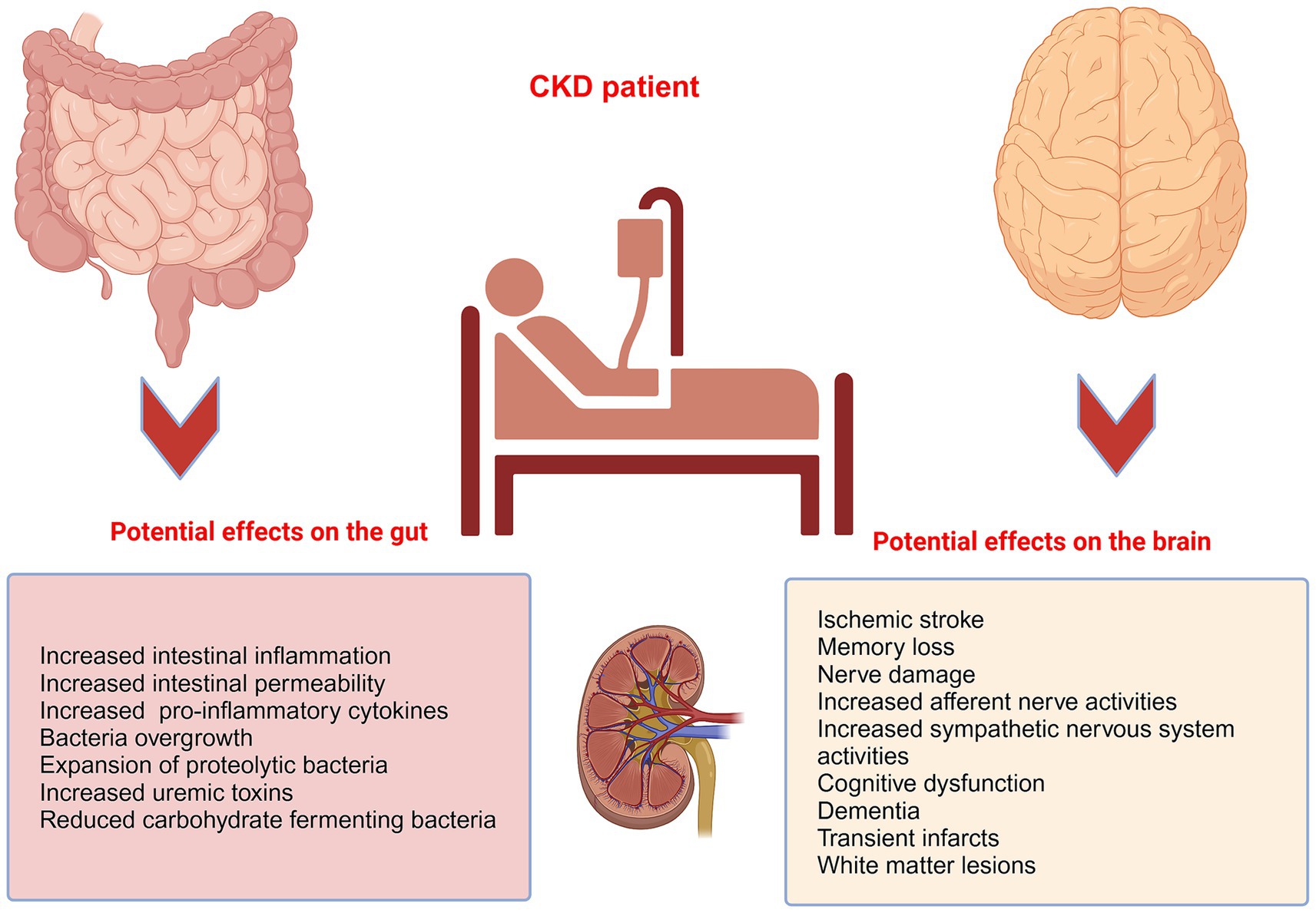 Diagram illustrating potential effects of chronic kidney disease (CKD) on the gut and brain. A patient in a hospital bed is centrally depicted. On the left, arrows point from intestines to text describing gut effects: increased inflammation, permeability, pro-inflammatory cytokines, bacterial overgrowth, proteolytic bacteria, uremic toxins, and reduced fermenting bacteria. On the right, arrows point from a brain to text describing brain effects: ischemic stroke, memory loss, nerve damage, increased nerve activities, cognitive dysfunction, dementia, infarcts, and white matter lesions. Kidney illustration is also included.