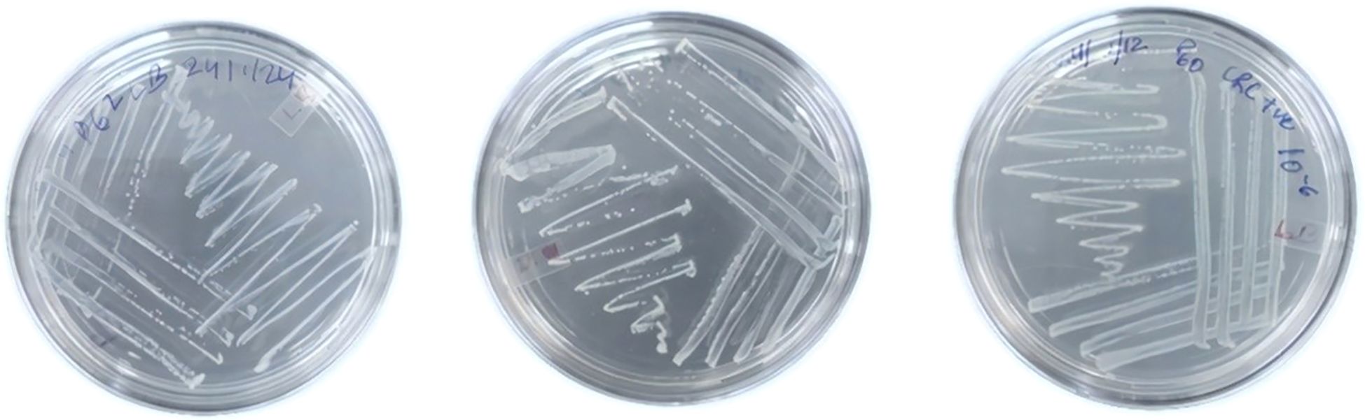 Three petri dishes with bacterial cultures showing streak patterns. The dishes have handwritten labels on the lids. Each dish displays distinct streaking techniques used for isolating microbial colonies.