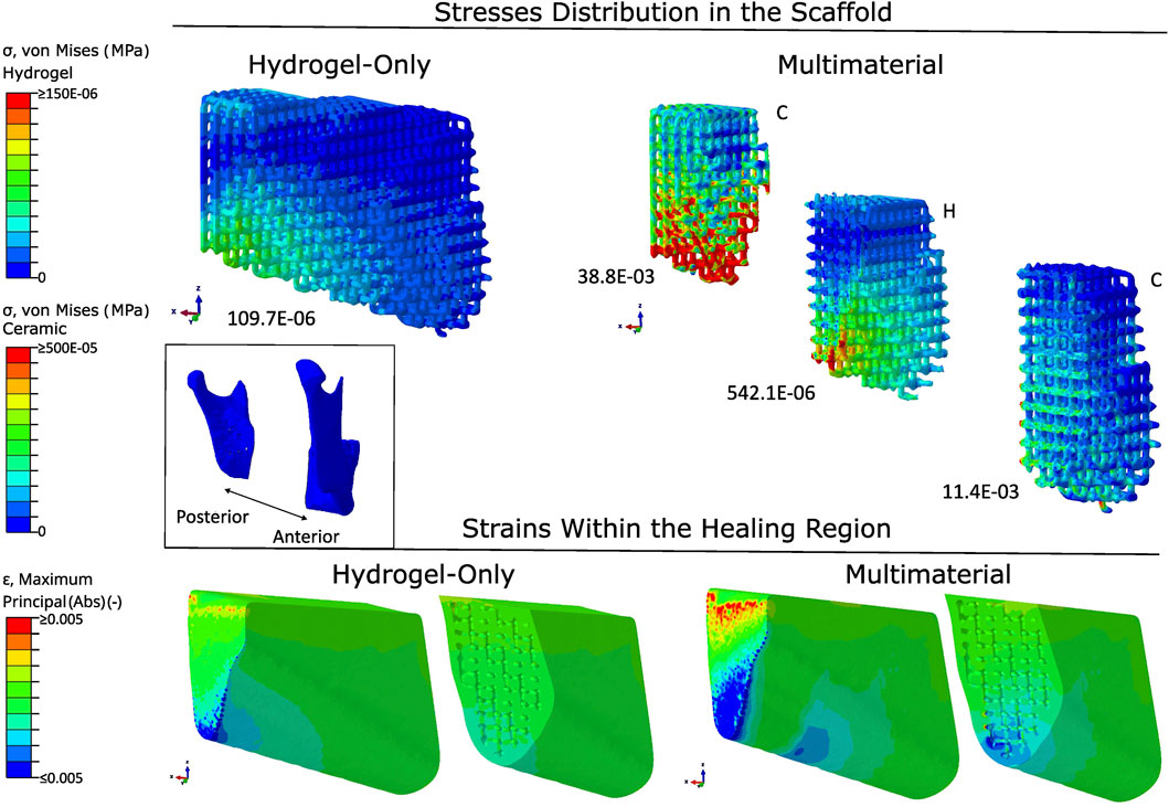 Stress and strain distribution in scaffolds. The top section shows hydrogel-only and multimaterial 3D scaffolds with varying stress levels. The bottom section exhibits strains within the healing region, comparing hydrogel-only and multimaterial responses, with color gradients indicating levels. Two scales on the left show stress and strain values in MPa. The inset displays posterior and anterior views.