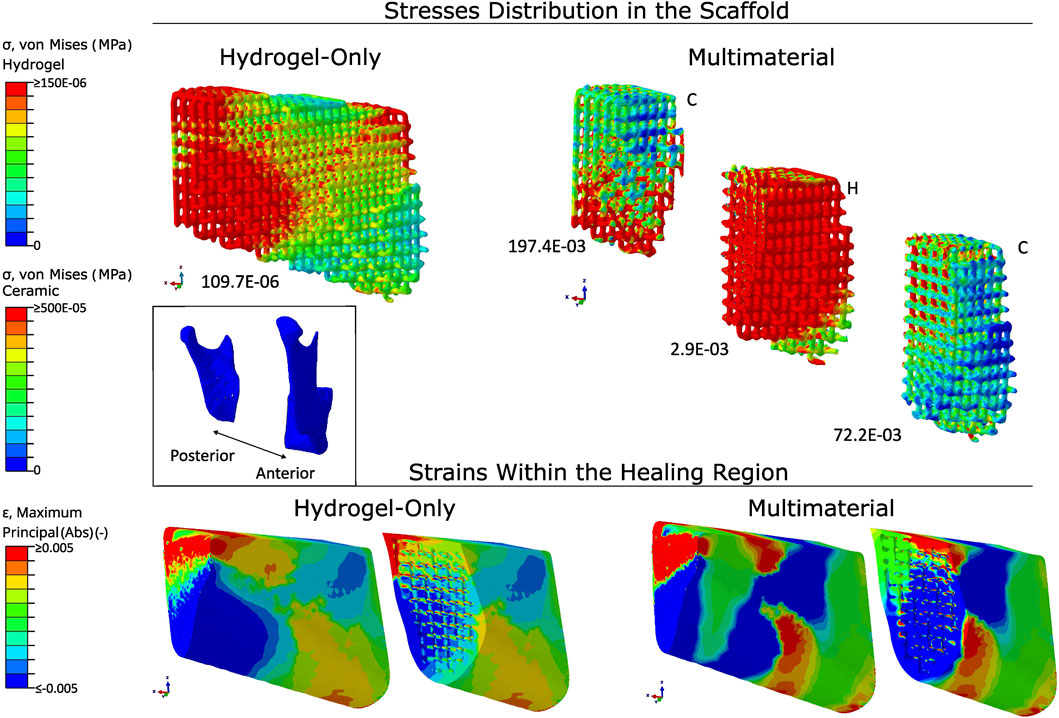 Stress and strain distribution in scaffolds is shown, with hydrogel-only and multimaterial configurations. The top section shows stresses with color gradients indicating von Mises stress levels for hydrogel and ceramic. The bottom section illustrates strains within the healing region using color maps. Different material configurations are compared in their respective impact on stresses and strains. Insets provide anatomical context.