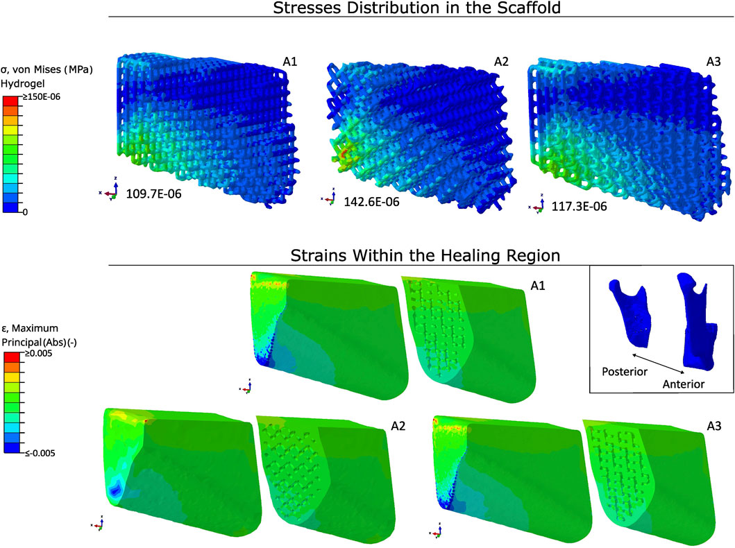 Visualization of stresses and strains in a scaffold and healing region. The top section displays the stress distribution in three scaffold configurations, labeled A1 to A3, using a color scale from blue to red. Numerical values indicate stress levels. The bottom section illustrates strain distribution in the healing region for each configuration, also labeled A1 to A3, with a corresponding color scale from green to red. An inset shows a schematic of the anterior and posterior views. Color bars on the left represent stress and strain metrics.