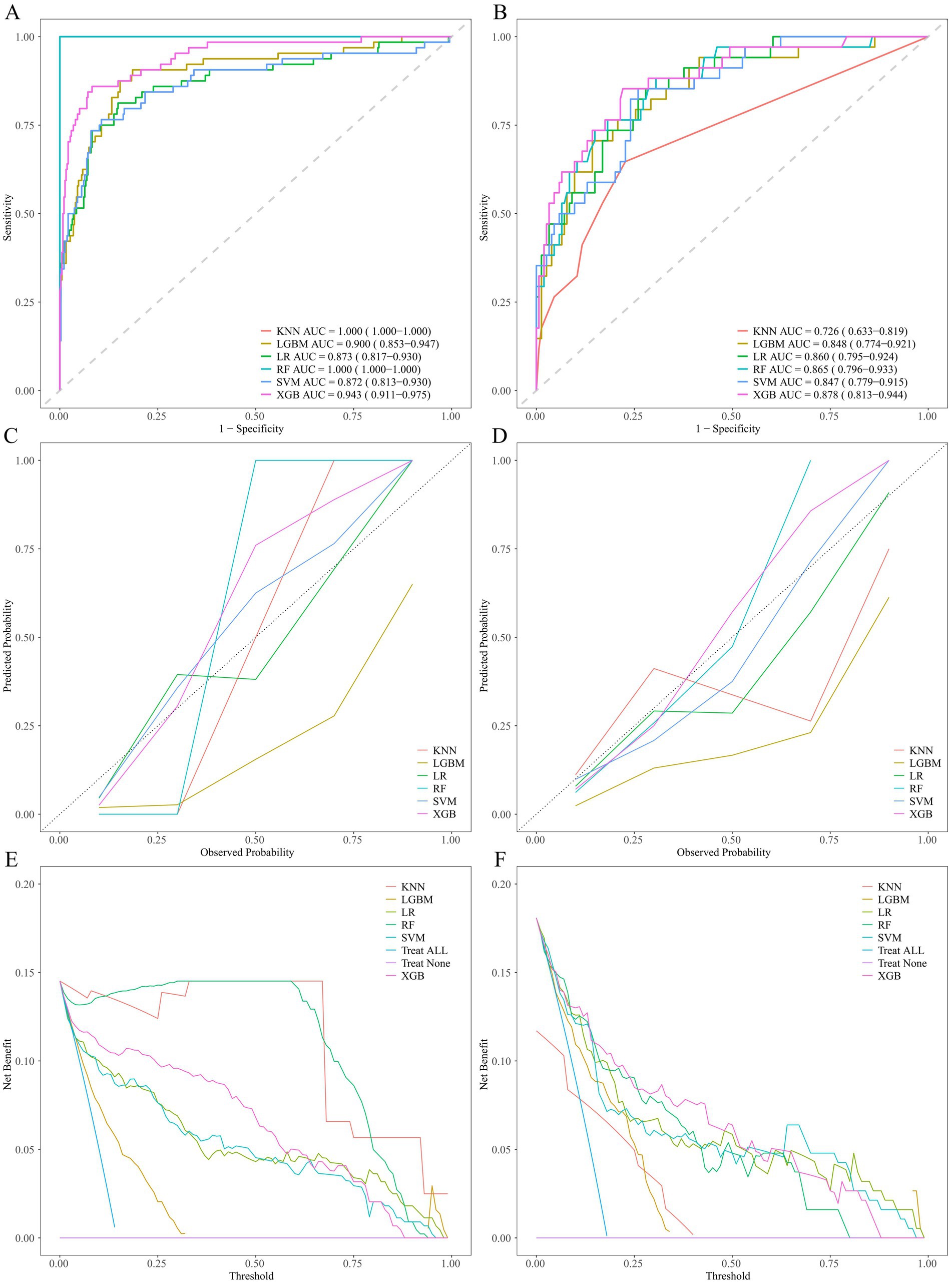 Six-panel image showing performance metrics for different machine learning models. Panels A and B display ROC curves, Panels C and D show calibration plots, and Panels E and F illustrate decision curves. Models compared include KNN, LGBM, LR, RF, SVM, and XGB. Each model’s AUC is listed, reflecting varying predictive performance. Lines represent different models, analyzing sensitivity, specificity, predicted probabilities, and net benefit across thresholds.