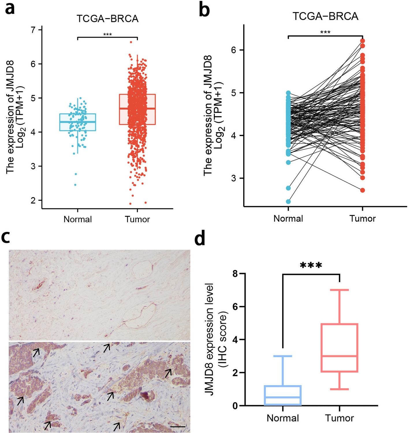 Four-panel image showing data related to JMJD8 expression in breast cancer. Panel (a) displays a scatter plot comparing JMJD8 expression in normal and tumor tissues, with higher expression in tumors. Panel (b) is a paired dot plot showing individual expression changes from normal to tumor tissues. Panel (c) includes two histological images with arrows indicating JMJD8 expression in tissues. Panel (d) presents a box plot illustrating higher JMJD8 expression levels in tumors compared to normal tissues, with statistical significance indicated.