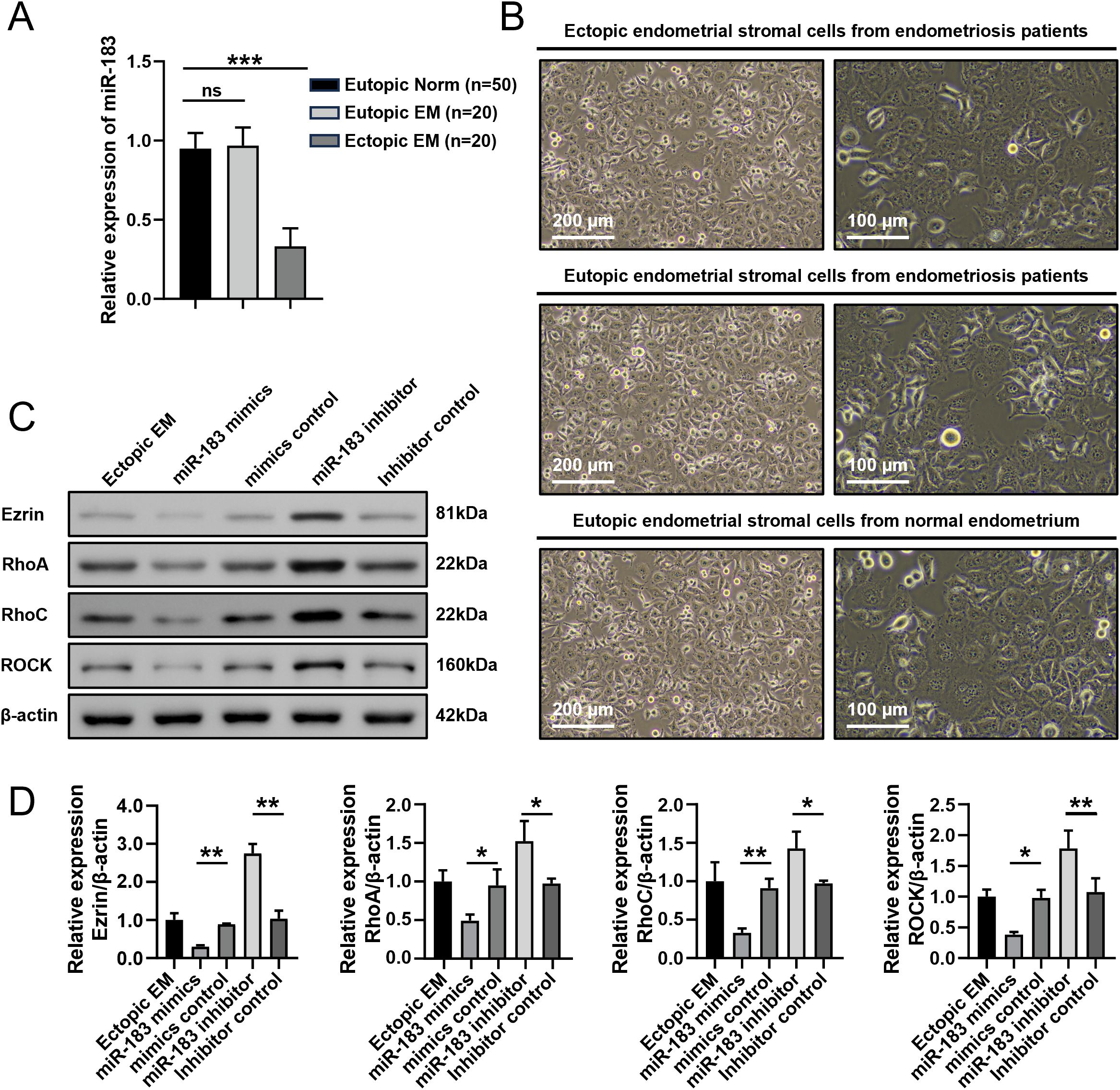 Panel A shows a bar graph comparing miR-183 expression levels in different endometrial tissues. Panel B presents microscopic images of stromal cells from ectopic, eutopic endometriosis, and normal endometrium with scale bars. Panel C is a western blot analysis of proteins, including Ezrin, RhoA, RhoC, and ROCK, with β-actin as control. Panel D features bar graphs depicting the relative expression of proteins observed in Panel C, with significant differences indicated by asterisks.