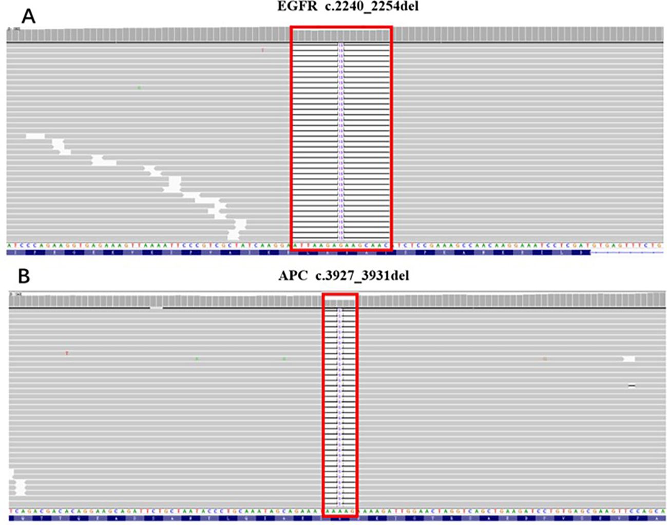 DNA sequencing graphs highlight two specific deletions. Panel A shows EGFR gene deletion c.2240_2254, and Panel B shows APC gene deletion c.3927_3931. Both deletions are marked by red boxes.