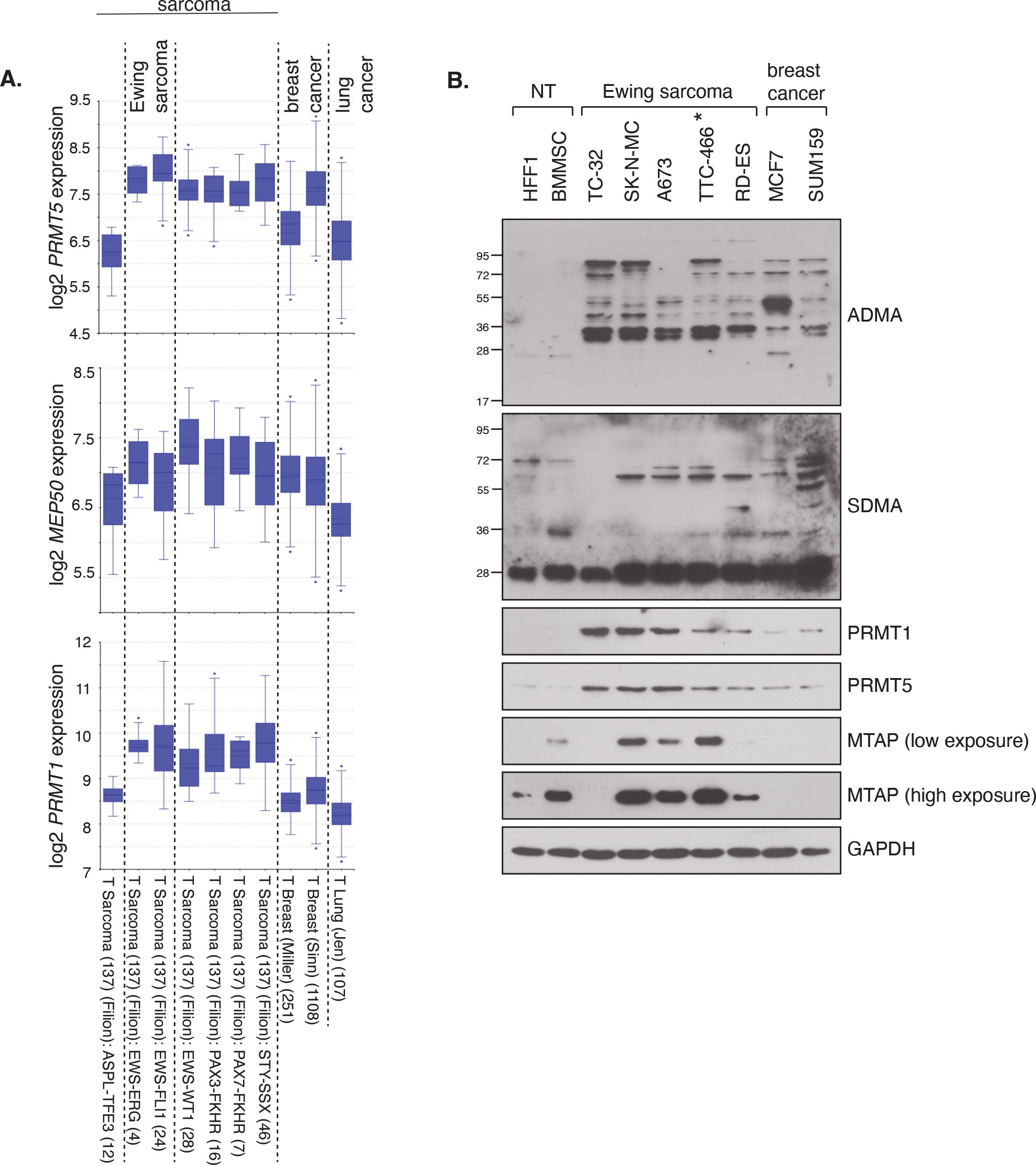 Panel A displays box plots showing the expression levels of PRMT5, MEP50, and PRMT1 genes across various Ewing sarcoma, breast cancer, lung cancer, and other tissue samples. Panel B shows Western blot analyses for ADMA, SDMA, PRMT1, PRMT5, MTAP (low and high exposure), and GAPDH across non-tumor (NT), Ewing sarcoma, and breast cancer samples, with bands indicating protein levels.