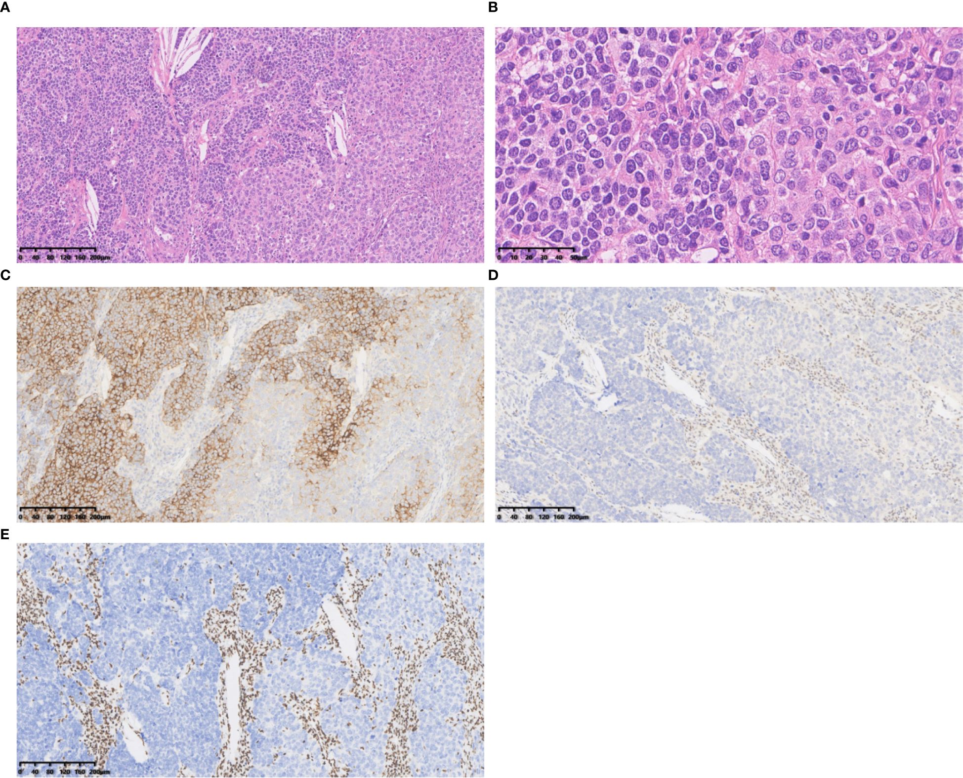 Five microscopy images labeled A to E. Image A shows a light purple-stained tissue section with dense cellular structures. Image B is a close-up of A, highlighting more detailed cell structures. Images C to E show different staining patterns with brown and light blue hues, indicating various cellular and tissue expressions. All images have scale bars for measurement.
