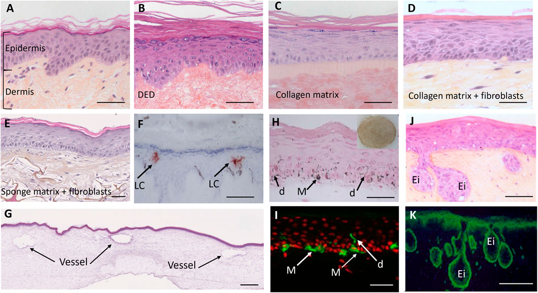 Histological slides in a grid format show reconstructed skin tissue sections with varying structural and cellular compositions. Panels A to E depict variations in the dermal layers depending on the scaffold used: de-epidermized dermis, collagen matrix, and sponge matrix. Arrows in panels F, H, and I highlight specific elements such as Langerhans cells, vessels or melanocytes to increase skin physiology. Panel K and J displays a fluorescence image indicating epidermal and dermal boundaries in the case of Xeroderma Pigmentosum. Each slide includes scale bars for reference.