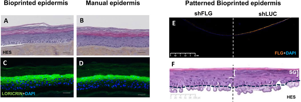 Comparison of bioprinted and manually seeded epidermis. Panels A and B show HES stained sections of bioprinted and manual epidermis, respectively. Panels C and D display fluorescence images showing LORICRIN and DAPI staining. Panel E illustrates the advantage of bioprintin by showing a patterned bioprinted epidermis with shFLG and shLUC keratinocytes. Panel F shows an HES stained section with a marked SG layer to highlight the nice differentiation.
