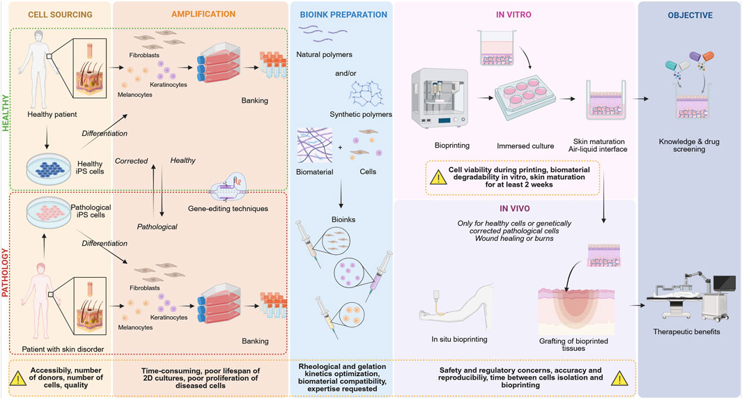 Diagram illustrating stages in creating and using bioprinted tissue. It includes cell sourcing, amplification, bioink preparation, and applications in vitro and in vivo. Healthy and pathological cells are differentiated, corrected through gene-editing, and banked. Bioinks are made from polymers and biomaterials, then combined withthe right cell type to be bioprinted. In vitro processes allow for skin maturation and skin constructs can then be used in vivo for burn grafting or wound healing. Bioengineered skins are mainly done for knowledge and drug screening, with challenges like cell viability and regulatory issues.