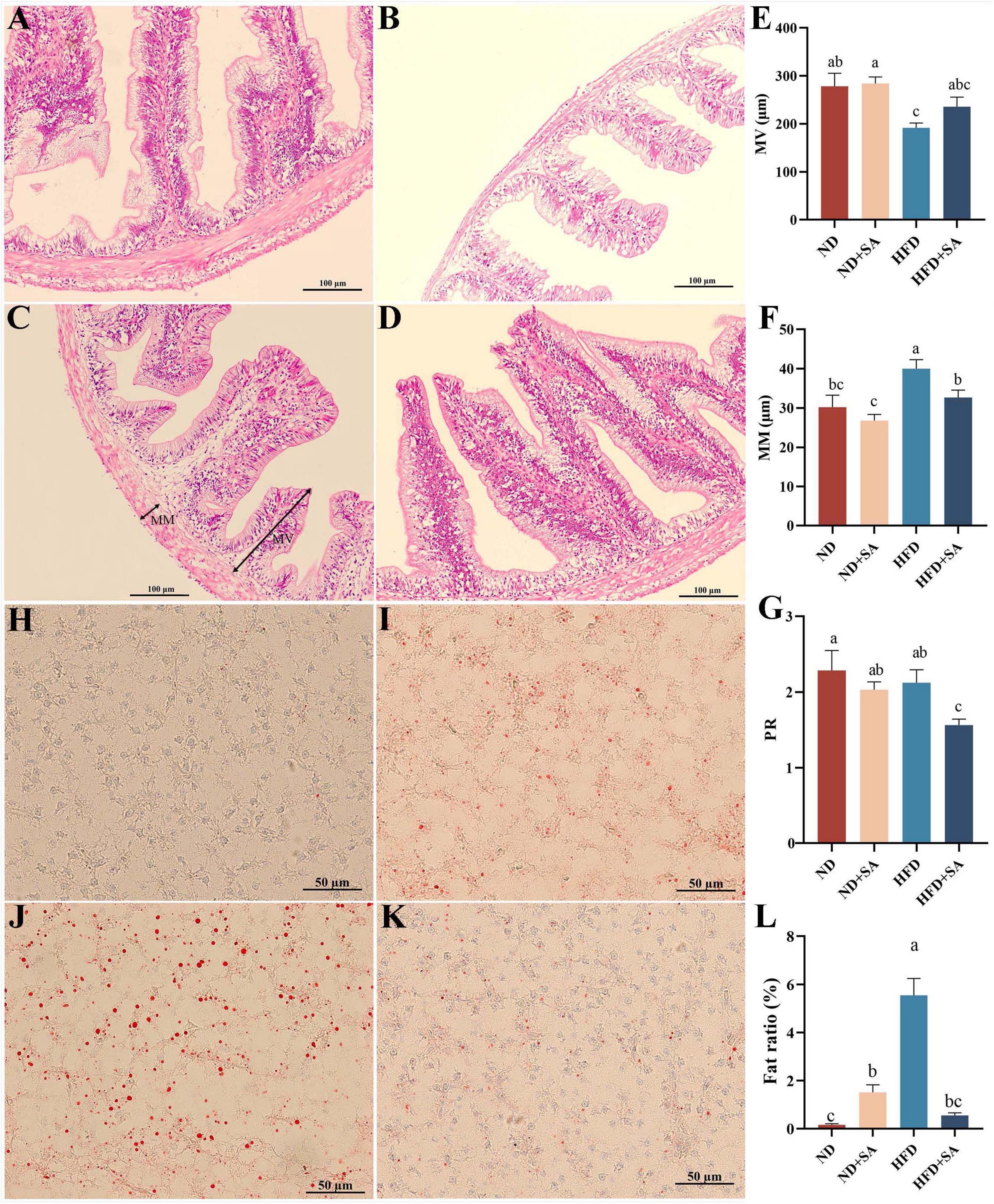 Microscopic images A to D show tissue samples with varying structures and cell densities, annotated with scale bars and labels. Corresponding bar charts E, F, G, and L display measurements such as MV, MM, PR, and fat ratio across different groups: ND, ND+SA, HFD, HFD+SA. Additional images H to K compare cellular details and distribution of spherical red-stained entities or cells in a matrix, each with a 50 micrometer scale. Charts indicate statistical letters (e.g., a, b, c) for significance levels.