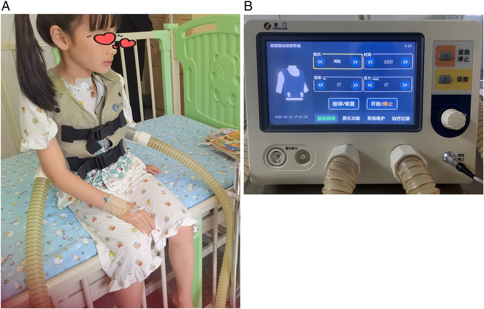 A child sits wearing a medical vest connected to tubes, likely part of a therapy device. Beside is a control unit displaying settings in Chinese, with buttons and indicator lights.
