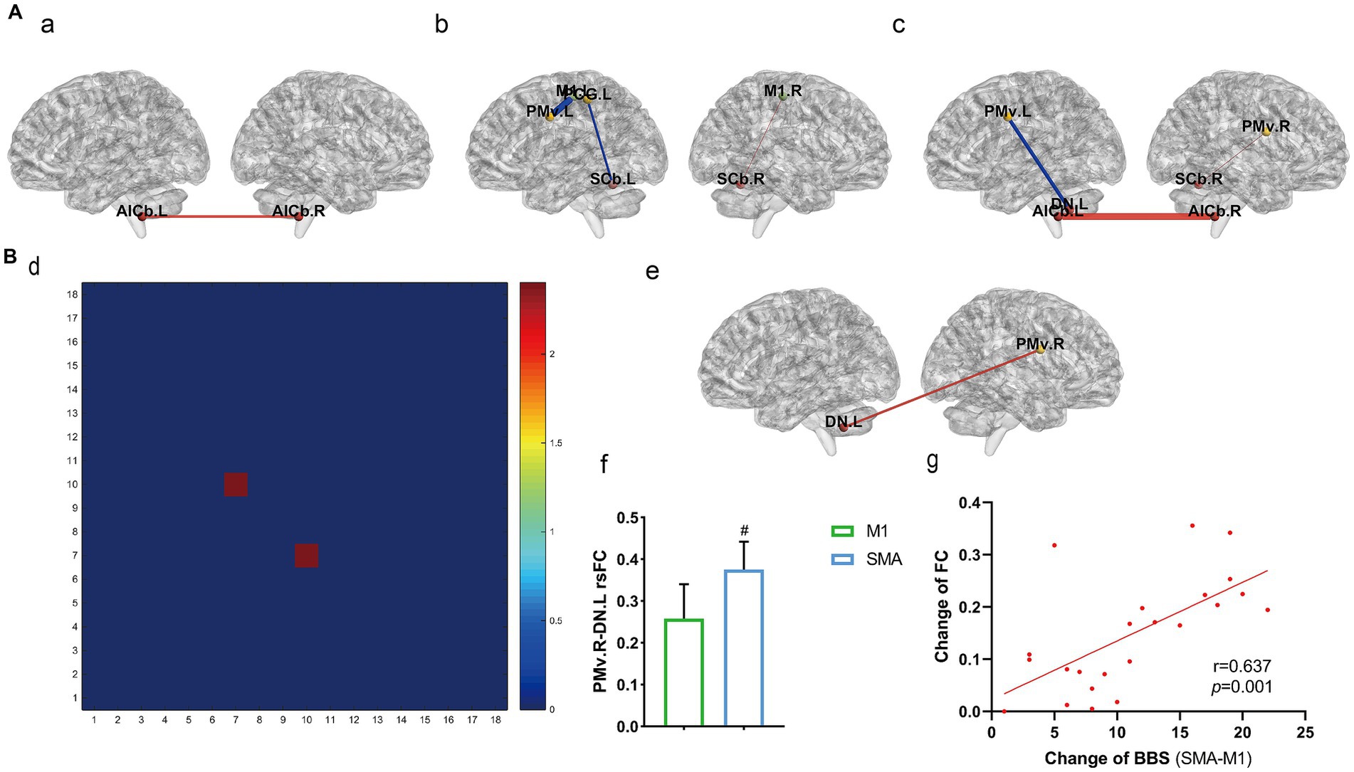 Brain connectivity analysis illustrated with five 3D brain diagrams (a, b, c, e), a heat map (d), a bar graph (f), and a scatter plot (g). The brain diagrams show connections between various brain regions, labeled with abbreviations like AICb, M1, PMv, and DN. The heat map uses a color scale from blue to red. The bar graph compares regions M1 and SMA with labels indicating statistical significance (#). The scatter plot shows a positive correlation between the changes in functional connectivity and BBS, with a correlation coefficient (r) of 0.637 and a p-value of 0.001.