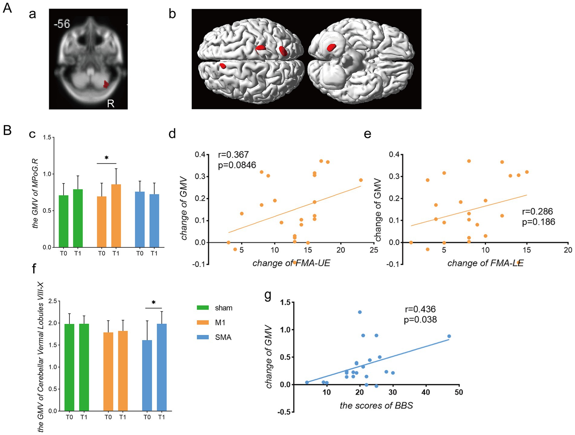 An image collage with several components: A) MRI scan showing a brain with highlighted regions in red. b) 3D brain model with red areas indicating specific regions of interest. B)c) Bar graph comparing GMV (gray matter volume) of MPdG.R across three groups (sham, M1, SMA) at two time points (T0 and T1), showing a significant change in the M1 group.d) Scatter plot showing the change of GMV versus change in FMA-UE with correlation data (r=0.367, p=0.0846).e) Scatter plot with GMV change versus change in FMA-LE (r=0.286, p=0.186).f) Bar graph for cerebellar vermal lobules VIII-X, highlighting significant change in the SMA group.g) Scatter plot relating GMV change to BBS scores with correlation data (r=0.436, p=0.038).