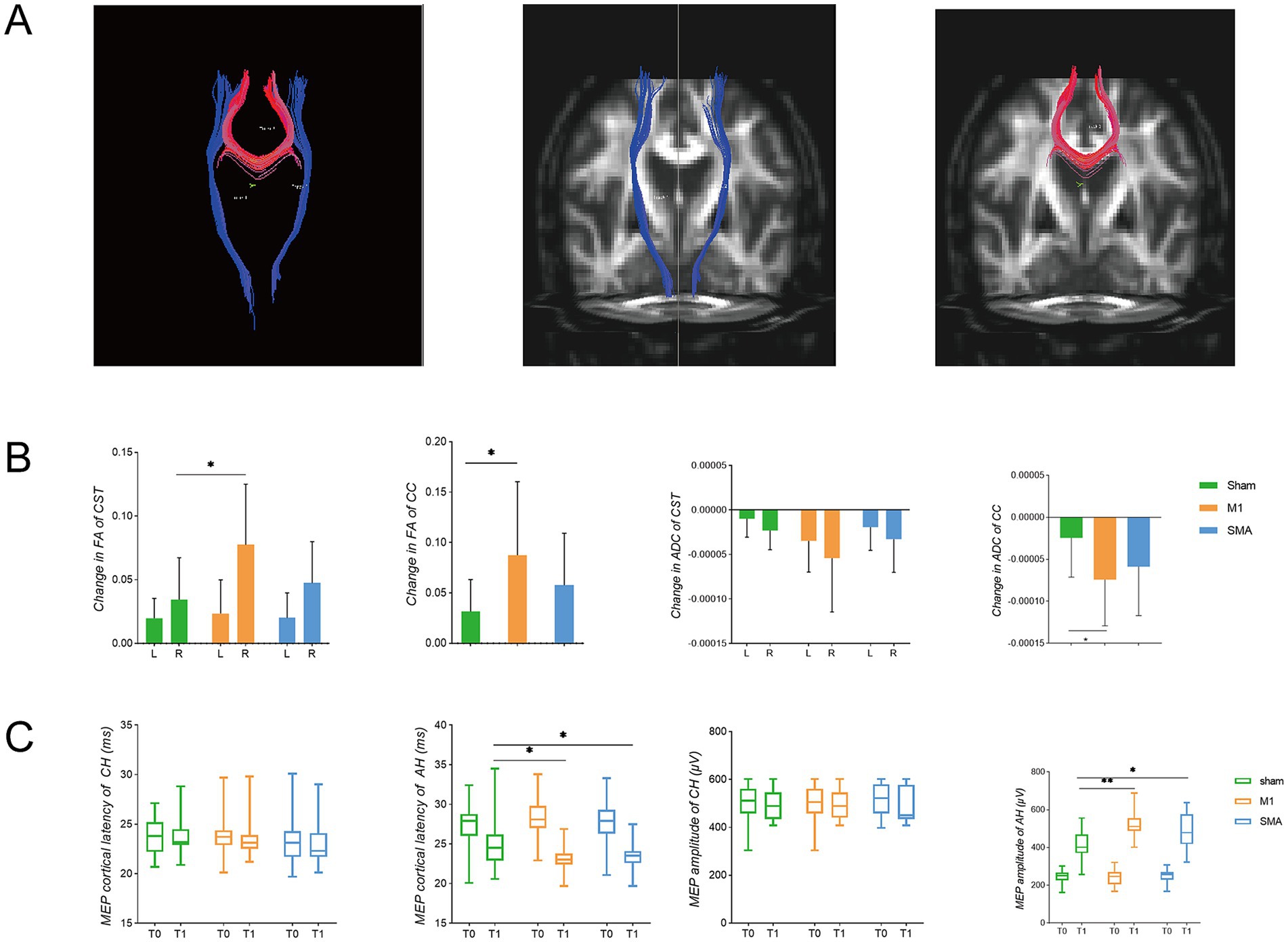 Part A shows three images of brain tractography, highlighting different tracts in blue and red on different backgrounds. Part B presents bar graphs showing changes in fractional anisotropy (FA) of CST and CC, and ADC of CST and CC, with color coding for Sham, M1, and SMA groups. Part C features box plots of MEP cortical latency and amplitude for different muscles over time (T0, T1) with similar group color coding. Asterisks indicate significant differences.