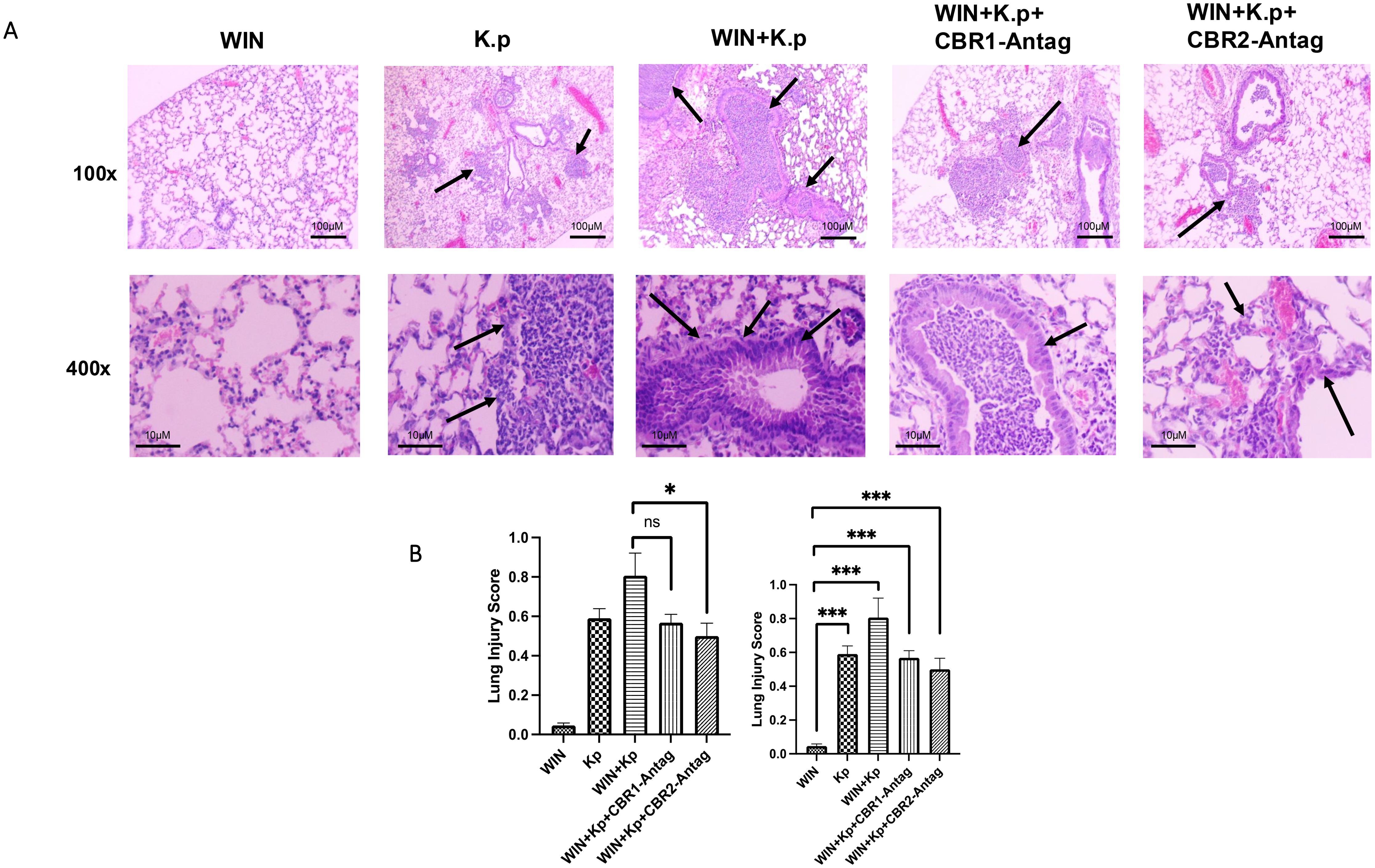 Panel A displays lung tissue microscopy images at two magnifications (100x and 400x) under different conditions: WIN, K.p, WIN+K.p, WIN+K.p+CBR1-Antag, and WIN+K.p+CBR2-Antag. Black arrows indicate areas of interest. Panel B shows bar charts comparing lung injury scores across these conditions, with statistical significance indicated by asterisks.