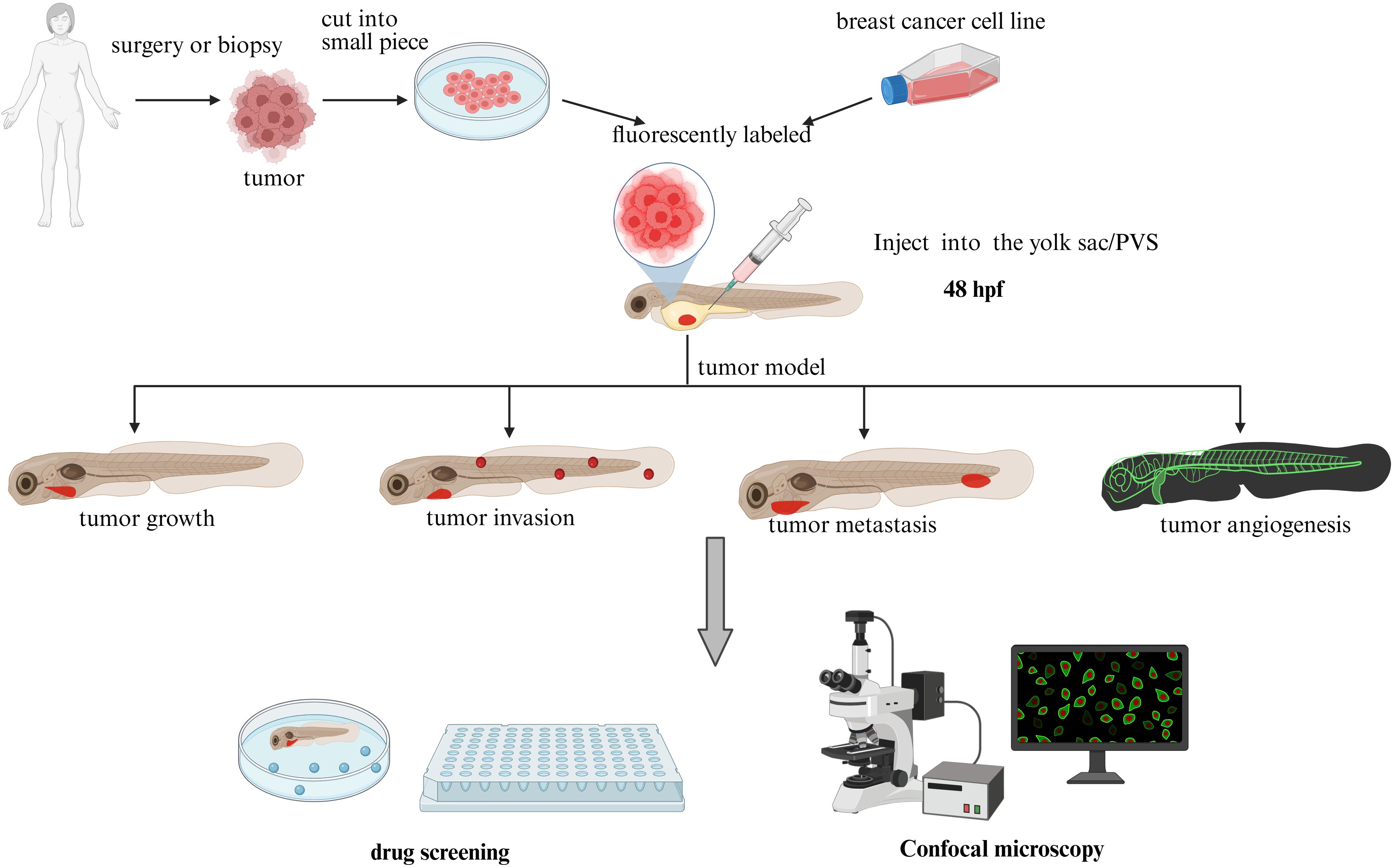 Diagram illustrating a tumor study process. A tumor is extracted via surgery or biopsy, cut into small pieces, and cultured in a dish. It is then fluorescently labeled and injected into the yolk sac/PVS of a fish at 48 hours post-fertilization, creating a tumor model. This model observes tumor growth, invasion, metastasis, and angiogenesis. Outcomes are analyzed using drug screening and confocal microscopy.