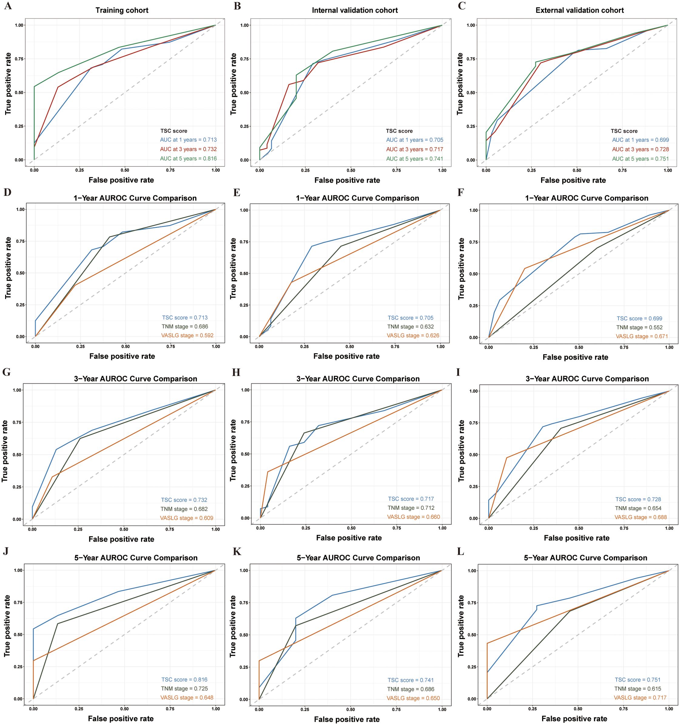 Twelve ROC curves are shown, labeled A to L, representing different cohorts and AUROC comparisons over one, three, and five years. Panels A-C illustrate ROC curves for training, internal validation, and external validation cohorts, respectively, with varying AUC values for different timeframes. Panels D-L compare AUROC curves at one, three, and five years for three scoring systems: TSC, TNM stage, and VALSG stage. Each panel displays true positive versus false positive rates, highlighting the performance of the scoring systems across different cohorts and time periods.