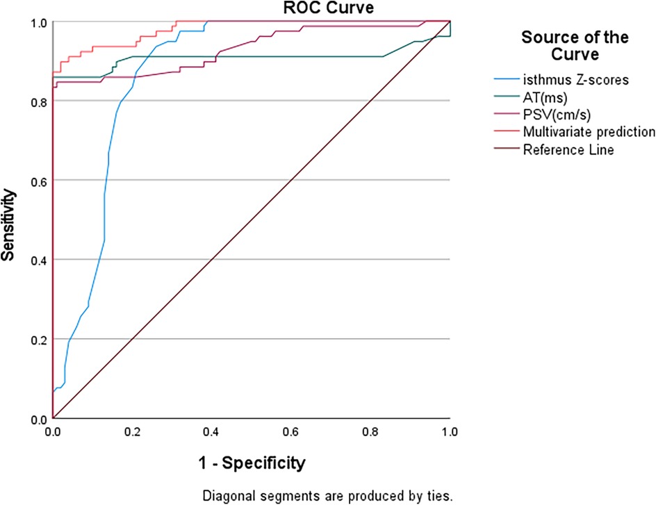 ROC curve graph showing the performance of different predictive models with sensitivity on the y-axis and one minus specificity on the x-axis. Curves represent isthmus Z-scores, AT(ms), PSV(cm/s), and multivariate prediction. The reference line shows random chance.