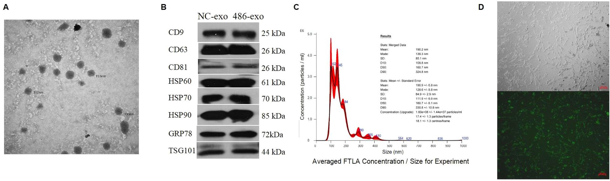 Panel A shows a grayscale microscopy image with various particles labeled by size in nanometers. Panel B displays Western blot results for NC-exo and 486-exo, illustrating protein expression levels for CD9, CD63, CD81, HSP60, HSP70, HSP90, GRP78, and TSG101, with molecular weights in kilodaltons. Panel C features a graph of particle concentration by size, with statistical results listed. Panel D contains two images of cells: an upper grayscale image and a lower fluorescent image displaying green-stained cells.
