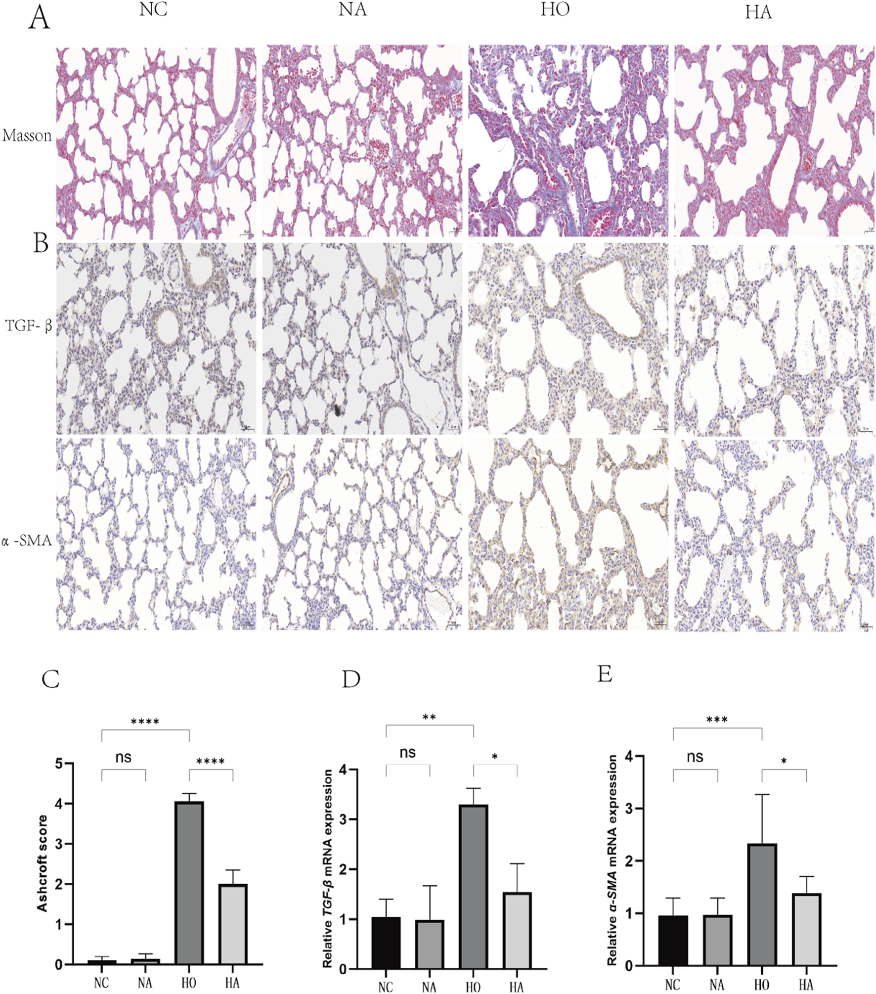 Histological and graphical comparison of lung tissues. Panel A shows Masson's trichrome staining of lung sections with different treatments (NC, NA, HO, HA), highlighting differences in fibrosis. Panel B depicts immunostaining for TGF-β and α-SMA, indicating expression levels. Panel C shows a bar graph of Ashcroft scores, with significant differences marked. Panels D and E display bar graphs for relative TGF-β and α-SMA mRNA expression, respectively, with statistics denoted by asterisks.