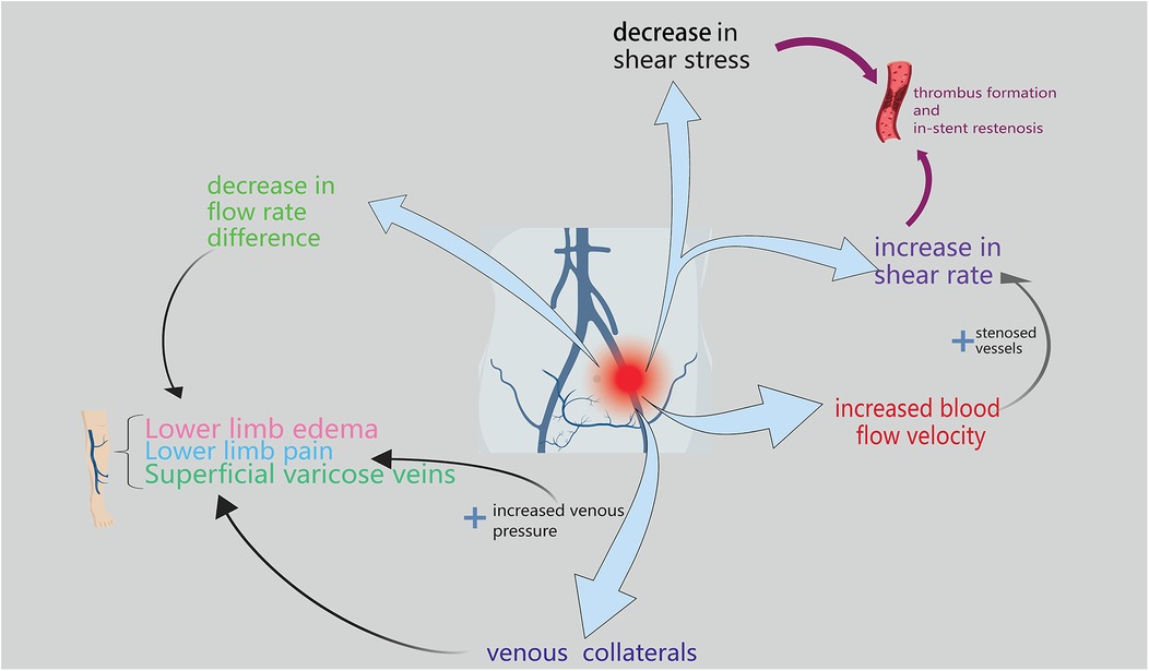 Diagram illustrating blood flow issues in the lower limbs. Center depicts venous collaterals, with arrows indicating flow changes: increased blood flow velocity, shear rate, and decreased shear stress. Effects shown include lower limb edema, pain, varicose veins, thrombus formation, and in-stent restenosis.