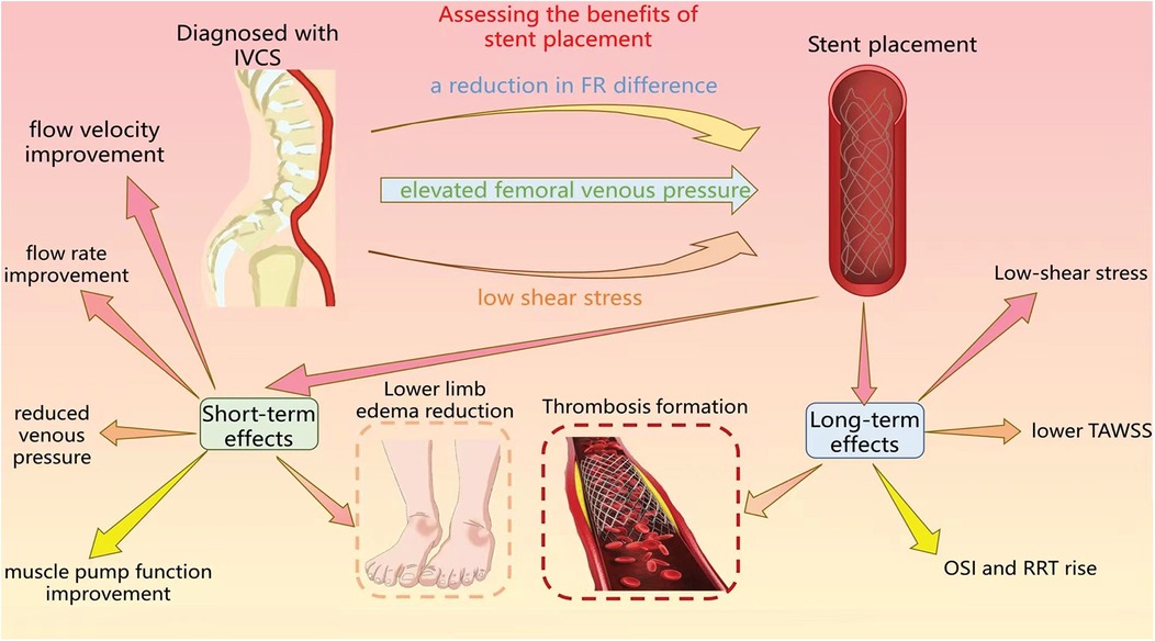 Flowchart illustrating the benefits of stent placement for those diagnosed with IVCS. The short-term effects include improved flow velocity and rate, reduced venous pressure, and muscle pump function improvement. Visuals depict lower limb edema reduction and thrombosis formation. Long-term effects noted are low-shear stress, lower TAWS, OSI, and RRT rise.